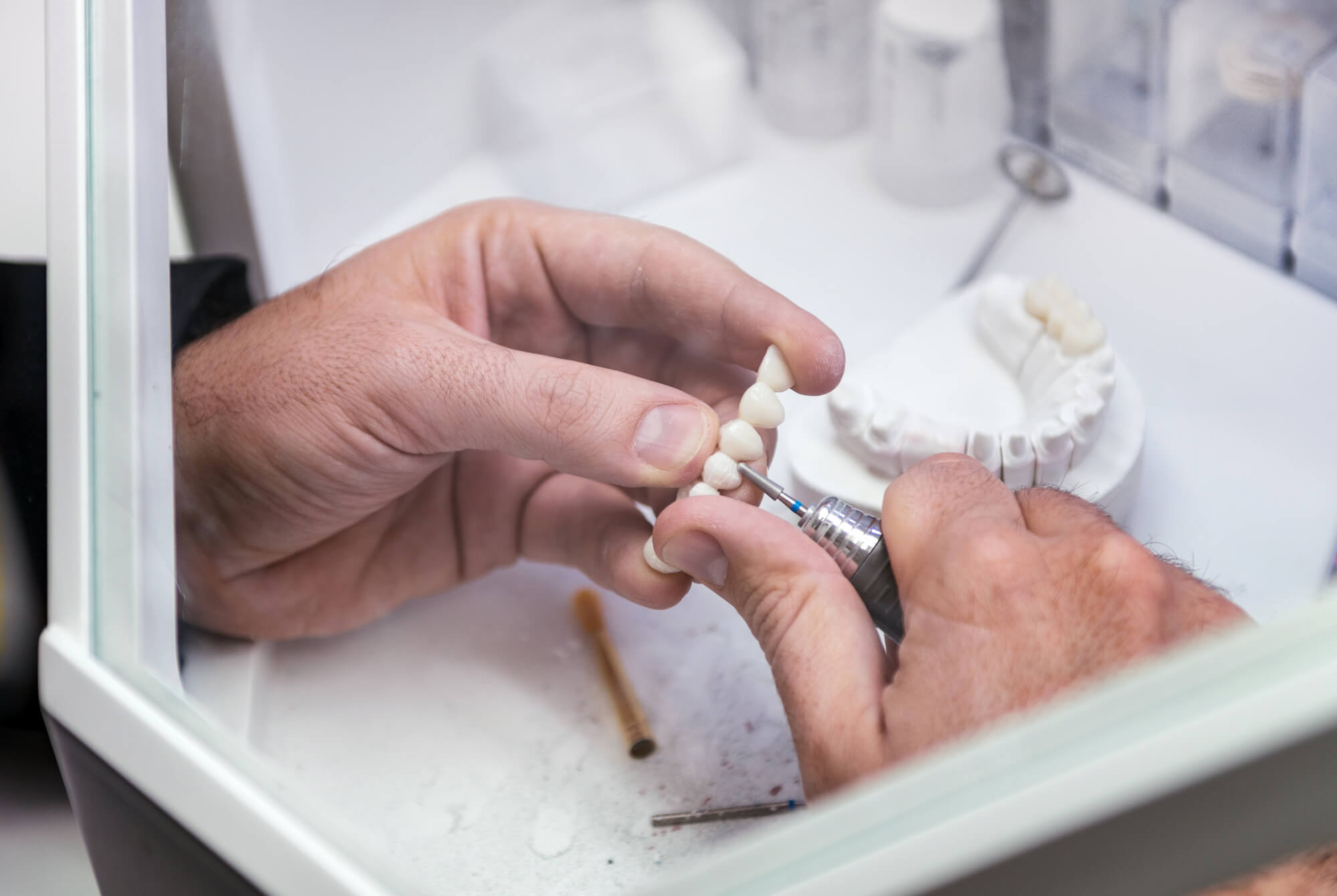 a Prosthodontist in Pompano Beach at work