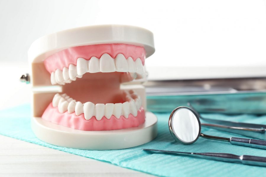 Illustration of Teeth Whitening in Pompano Beach