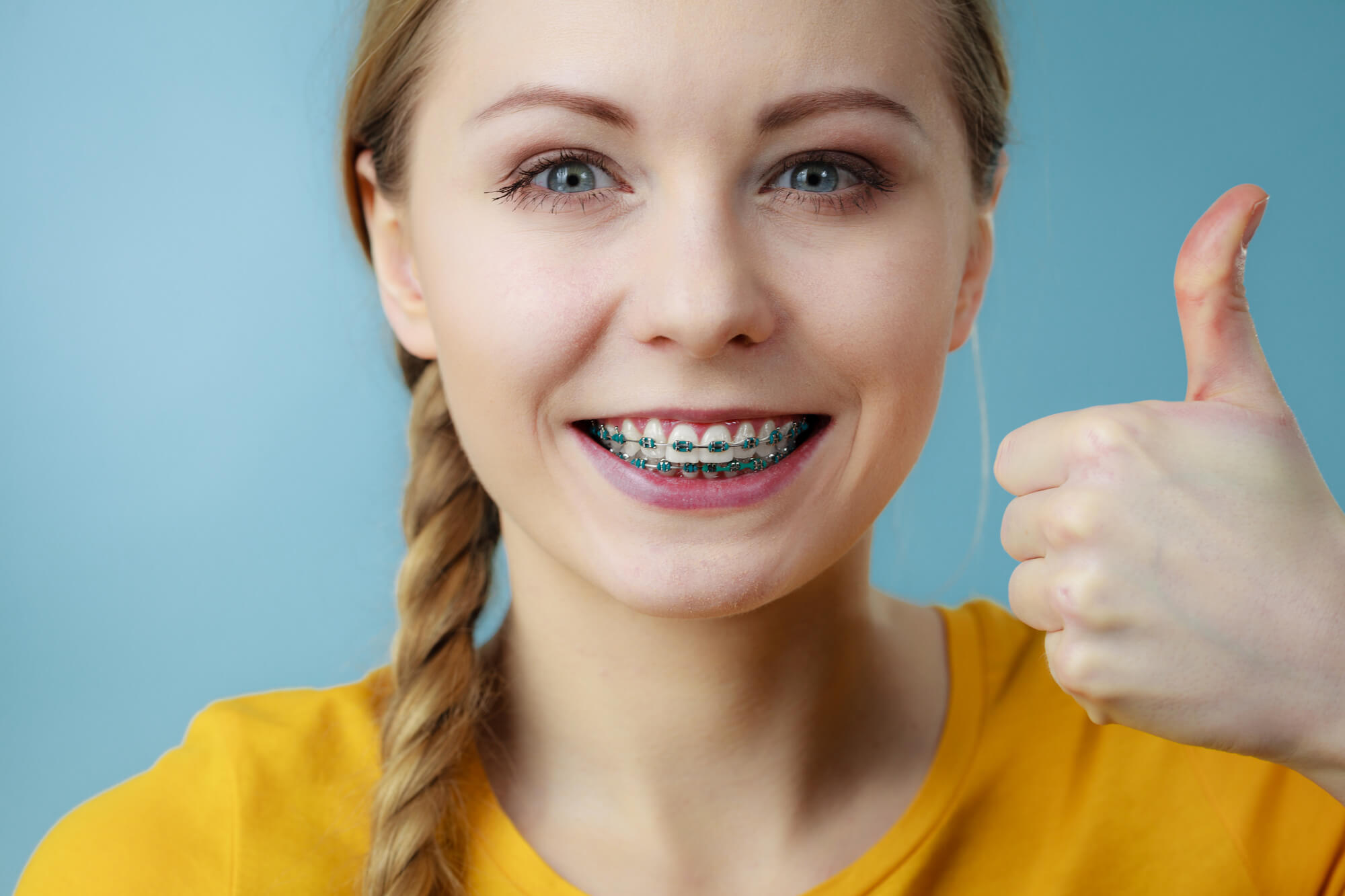 woman smiling and giving thumbs up while wearing Braces in Pompano Beach