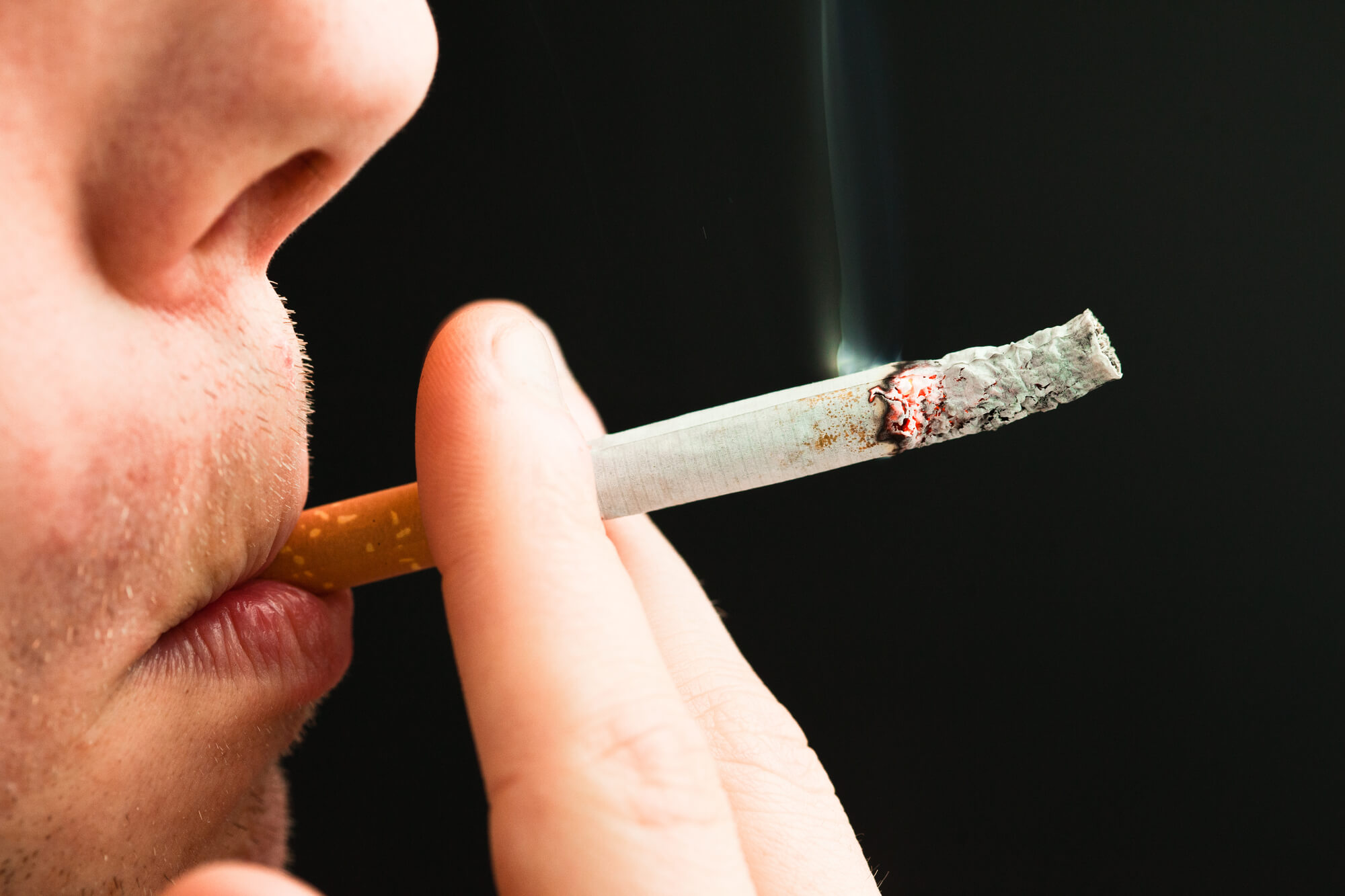 a smoker needing Dental Implants in Pompano Beach
