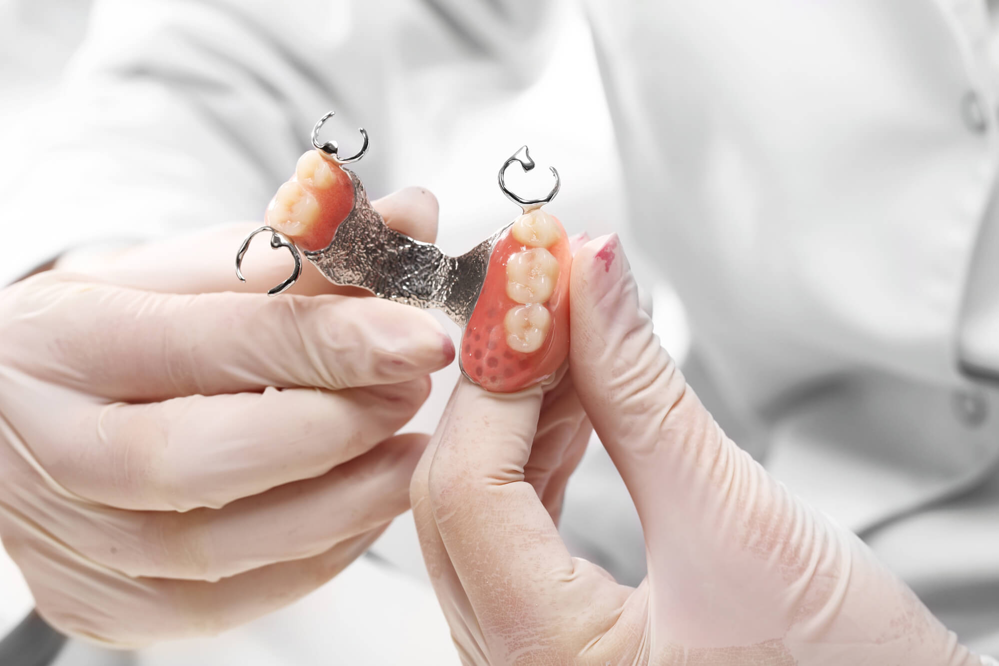 a Prosthodontist in Pompano Beach working on partial dentures