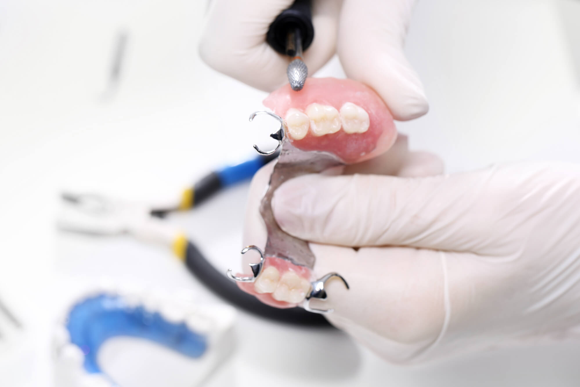 dentist working on partial Dentures in Pompano Beach