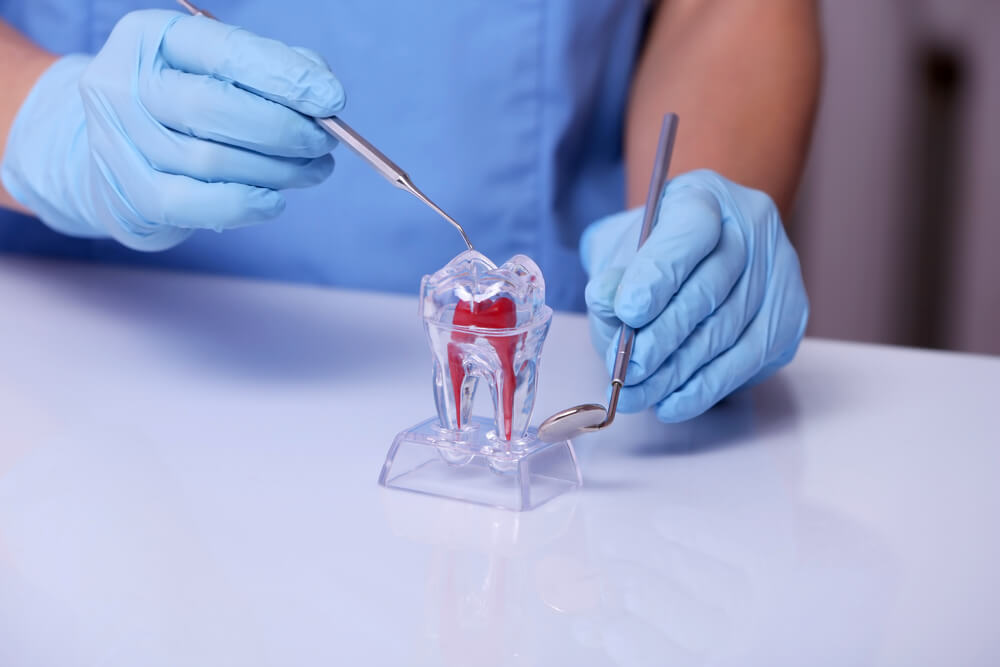 Prosthodontist in Pompano Beach working on an artificial tooth.