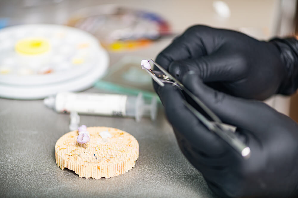 A prosthodontist in Pompano Beach creating false teeth for a patient.