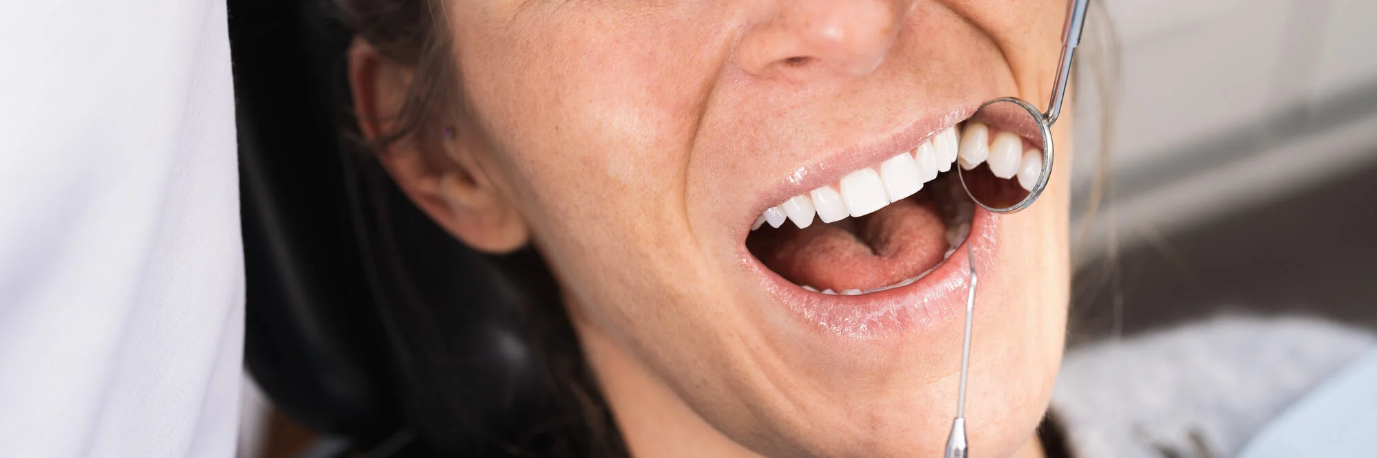 Dentist-checking-patient-smile-for-dental-bridges-in-Pompano-Beach
