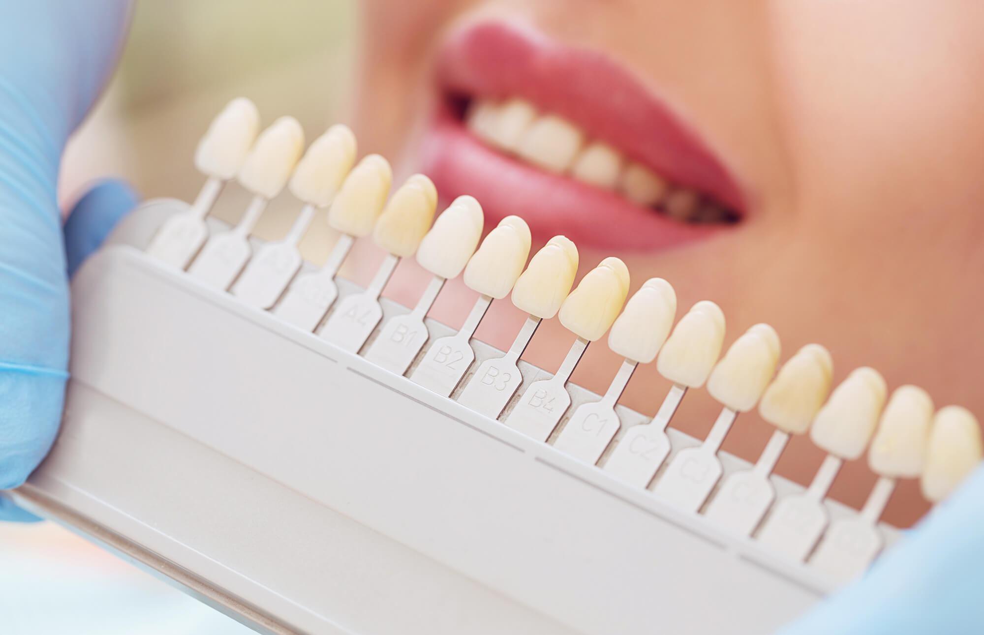 Dentist Showing a Set of Dental Implants Pompano Beach