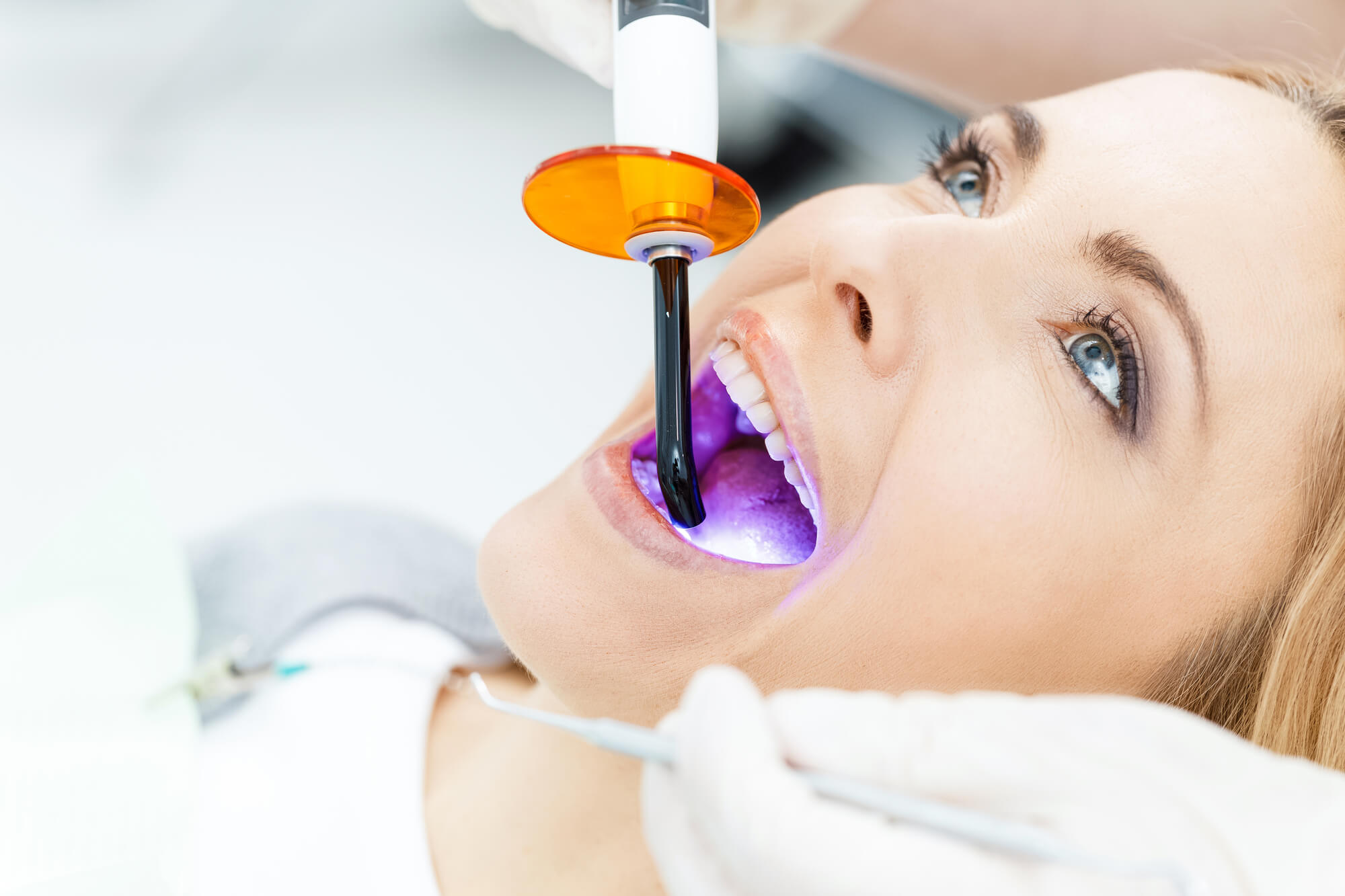 woman undergoing teeth whitening in Pompano Beach