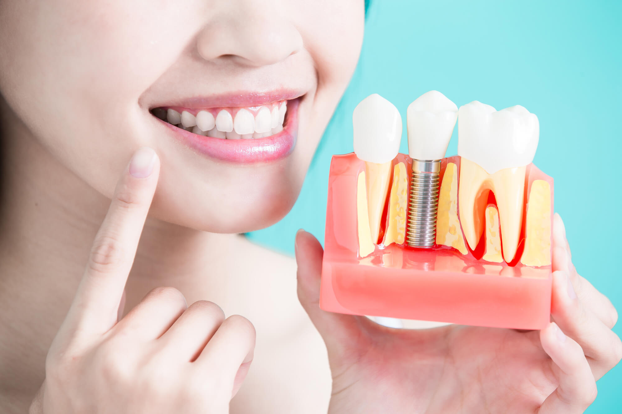 woman with dental implants in Pompano Beach