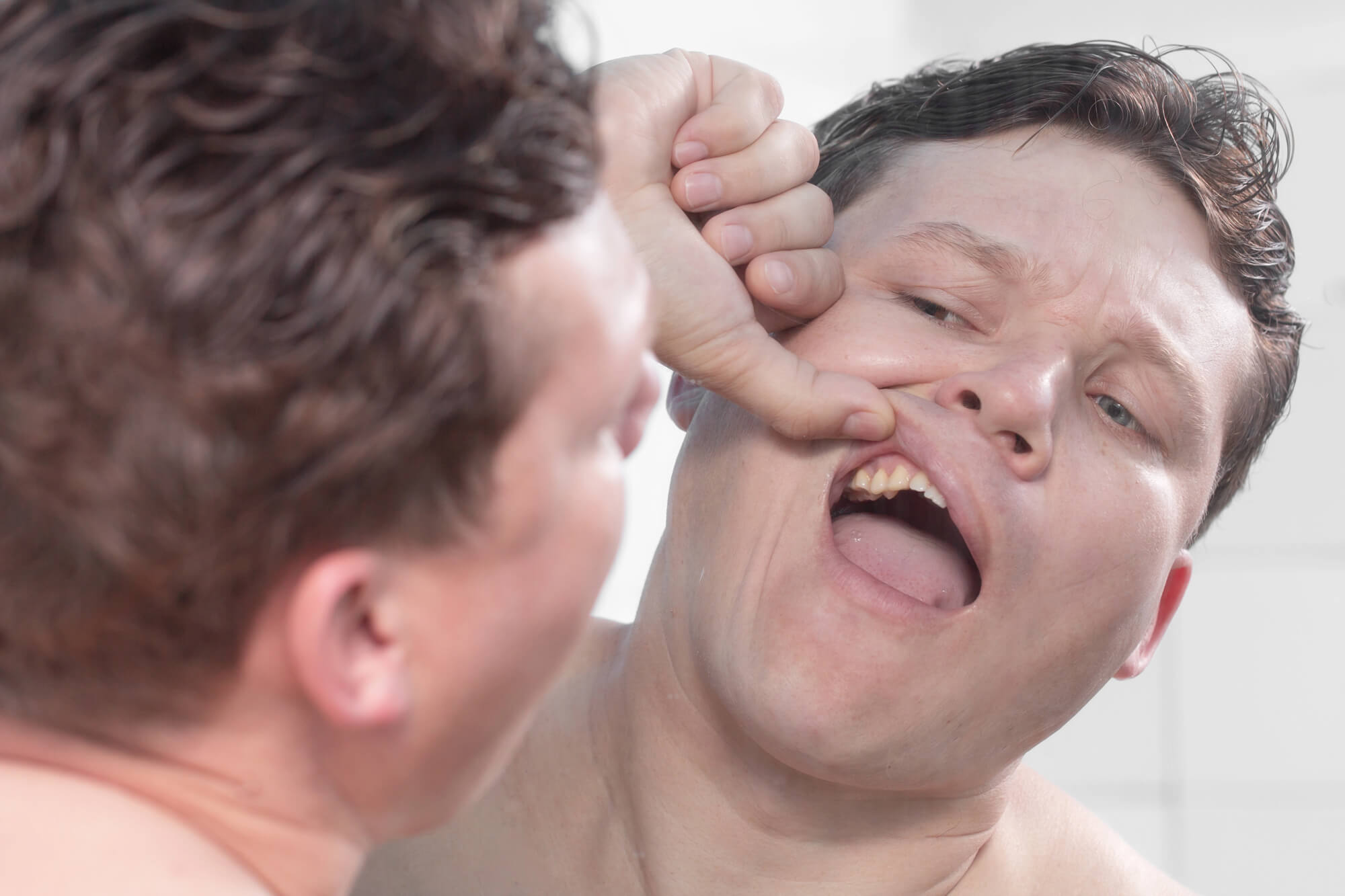 Signs Your Dental Bridges in Pompano Beach Need a Replacement