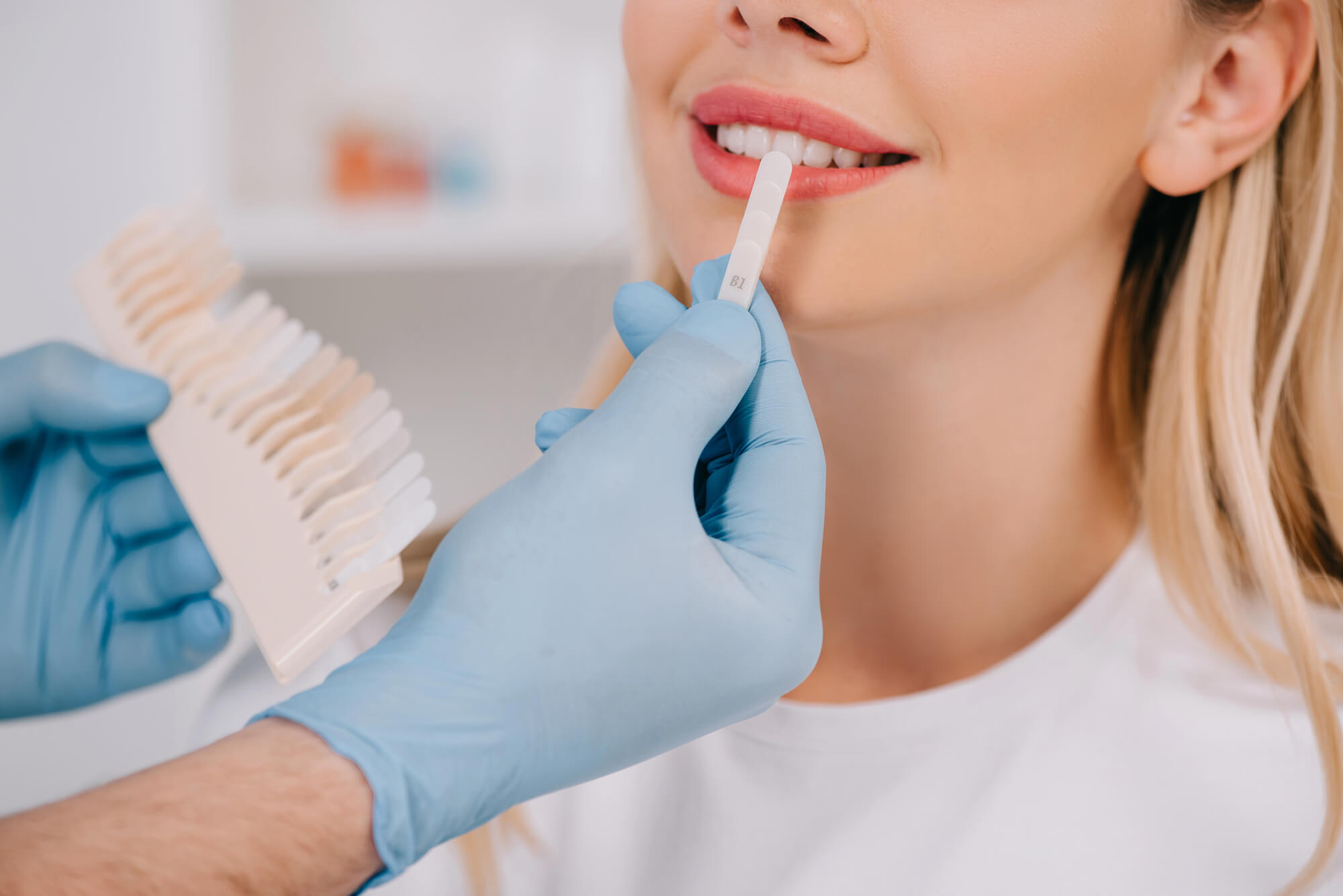 5 Teeth Whitening in Pompano Beach Tips Before a Vacation
