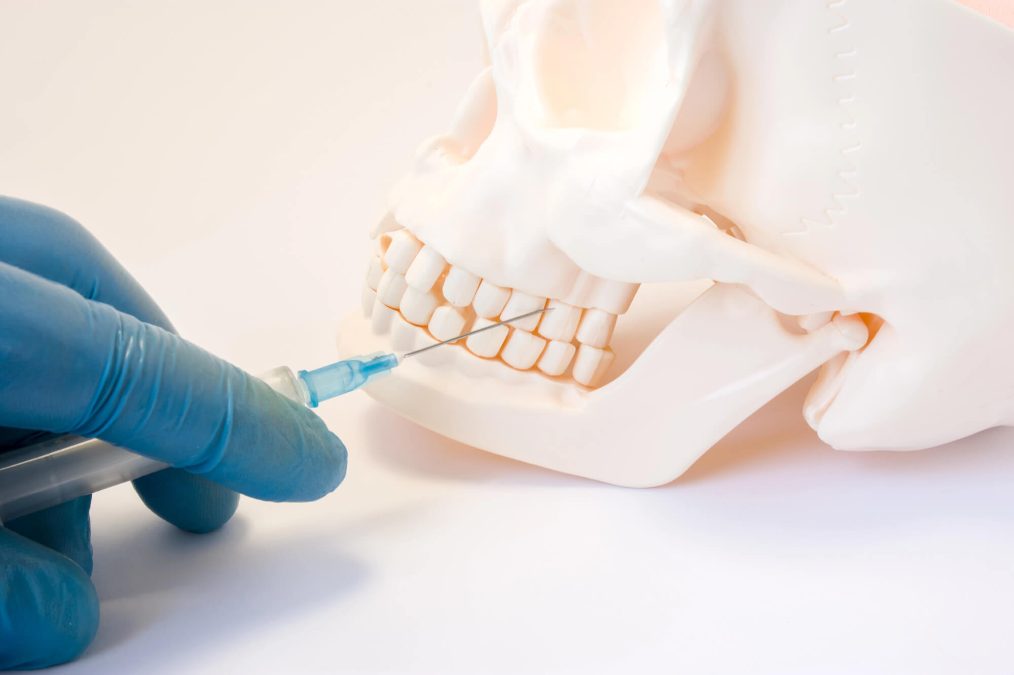 Do's and Don'ts After Sedation Dentistry in Pompano Beach