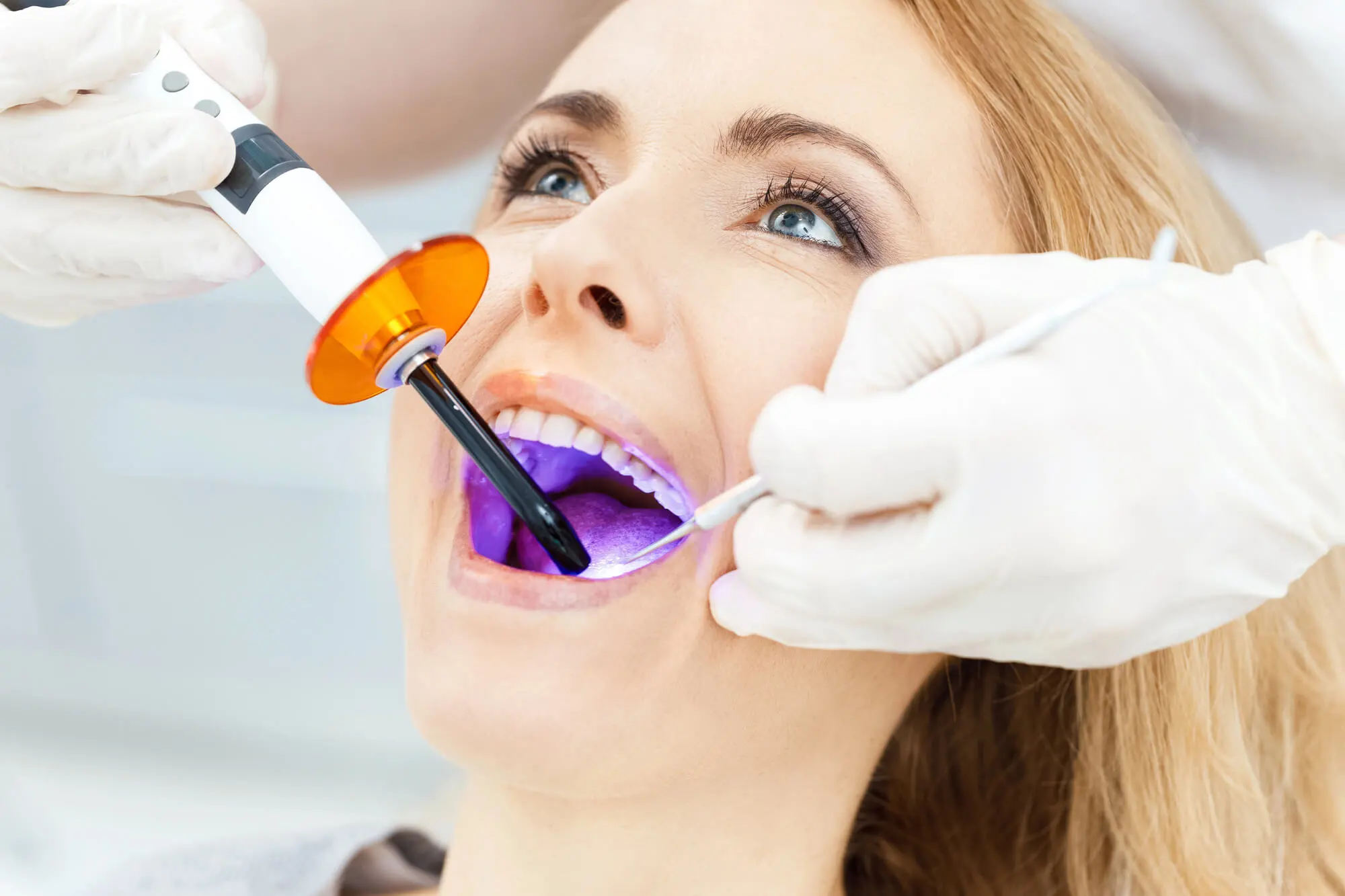 Teeth-Whitening-in-Pompano-Beach
