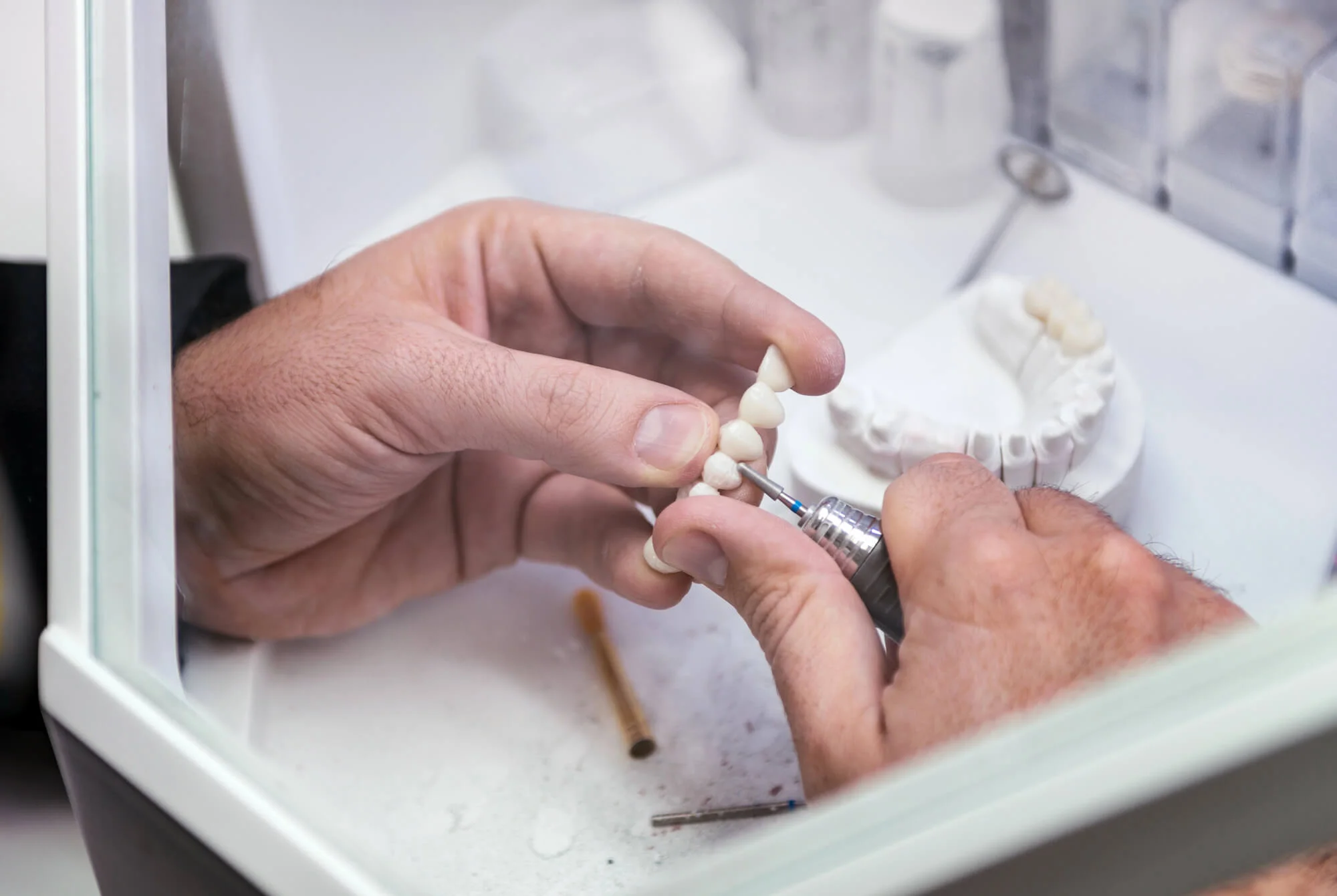 Dental technician polishing porcelain bridge prosthodontist in Pompano Beach