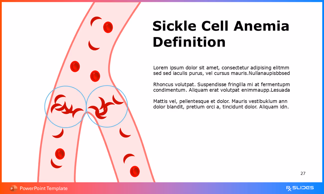 Understanding Sickle Cell Anemia – Close-Up View