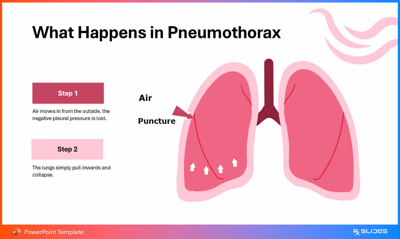 What Happens in Pneumothorax