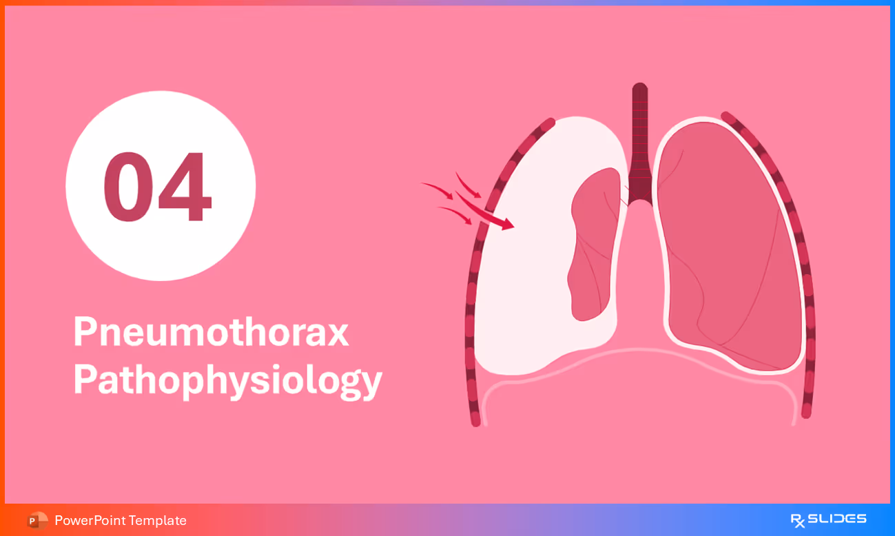 Pneumothorax Pathophysiology Section Divider