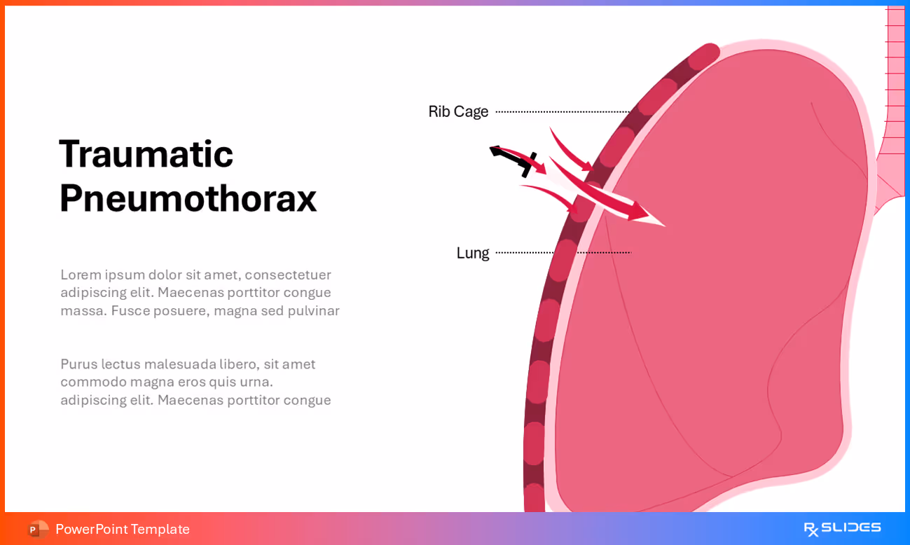 Traumatic Pneumothorax Pathogenesis Visualization