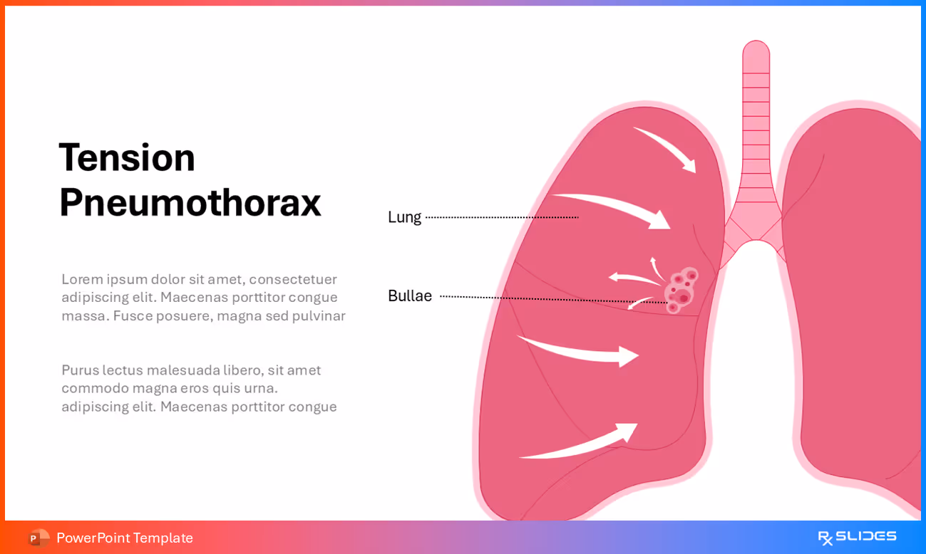 Tension Pneumothorax Pathogenesis Visualization