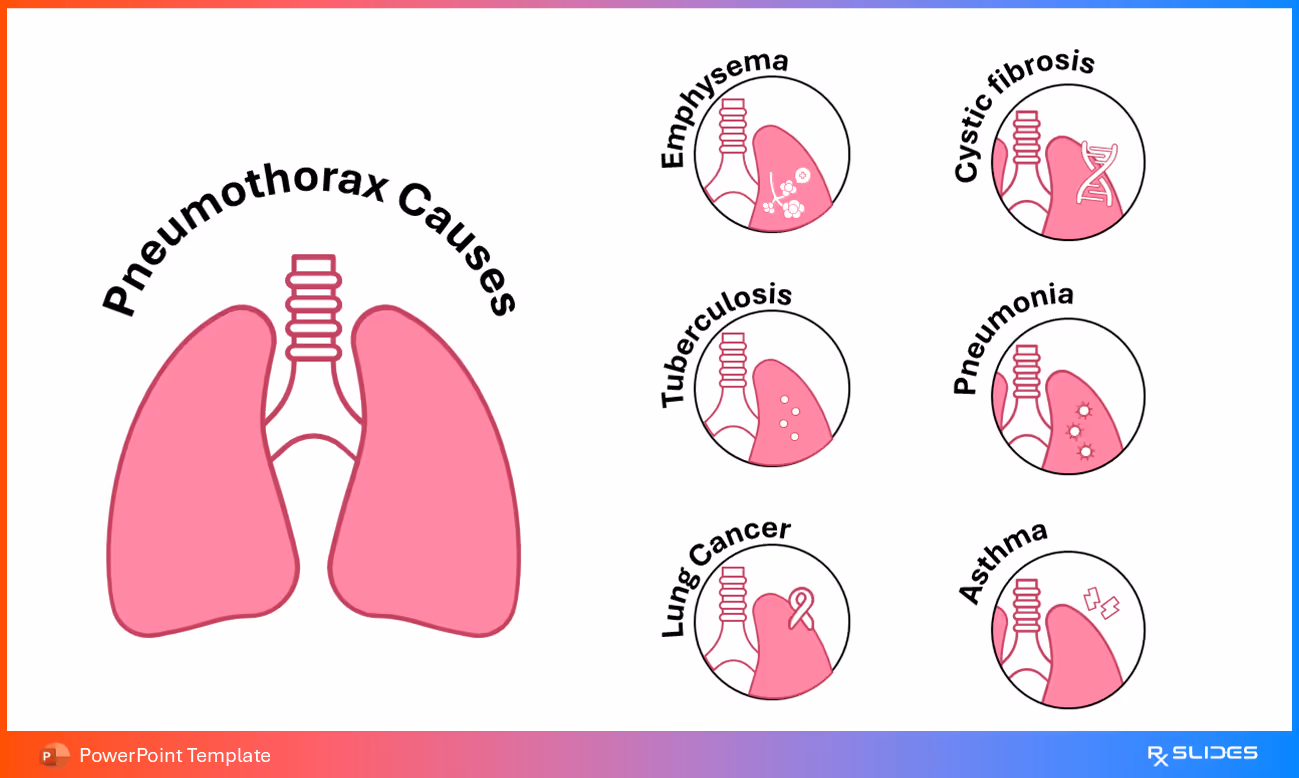 Pneumothorax Causes Rounded Infographic