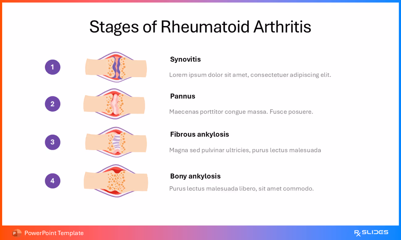 Detailed View of RA Stages