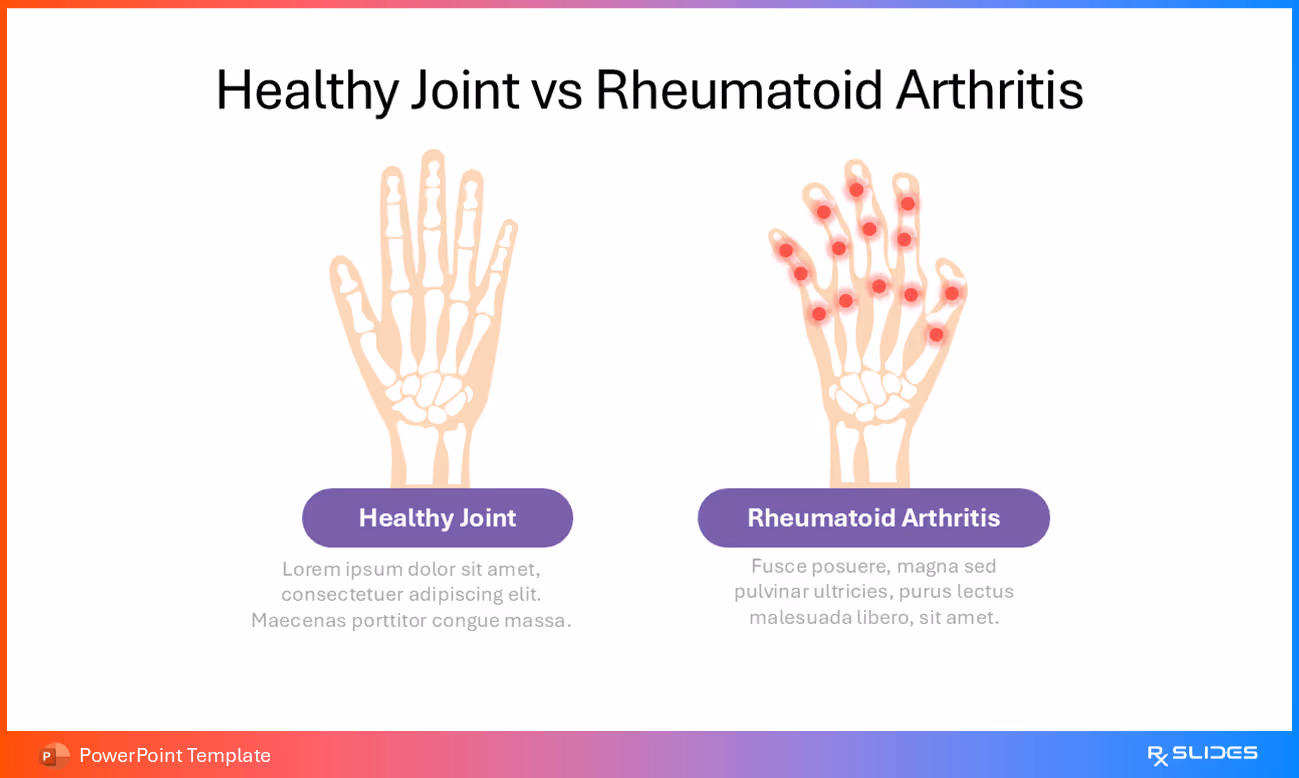 Healthy Joint vs. RA – Animated Comparison