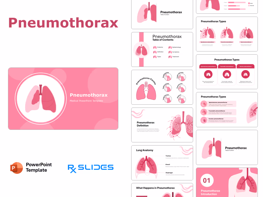 Pneumothorax PowerPoint Template