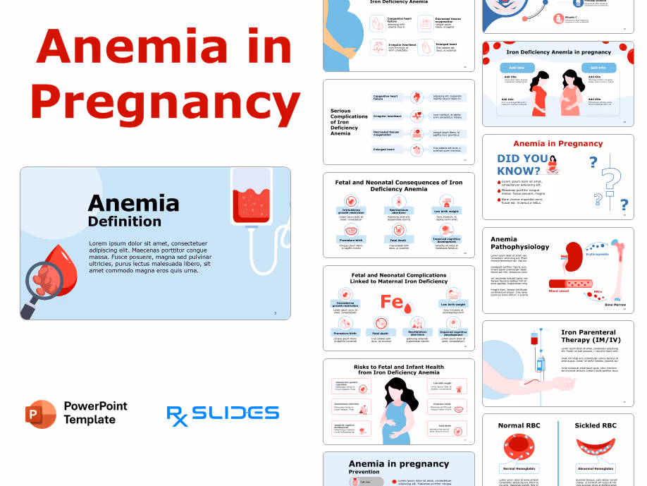 Anemia In pregnancy PowerPoint Template 