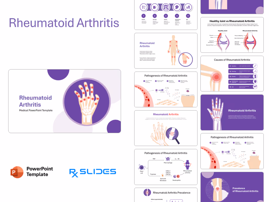 Rheumatoid Arthritis PowerPoint Template