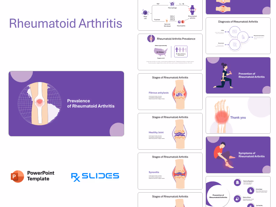 Rheumatoid Arthritis Presentation Template