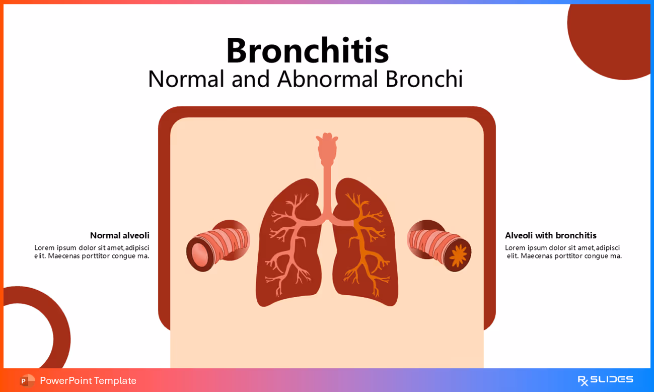 How Bronchitis Affects Alveoli
