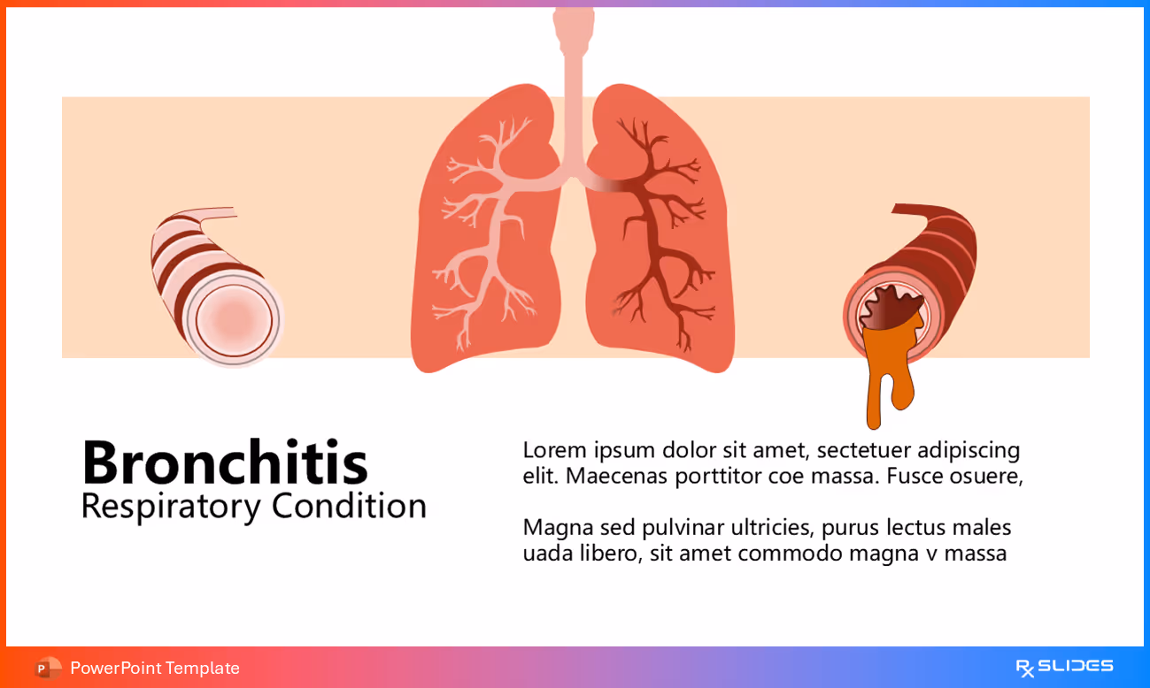 Slide 33: Bronchitis as a Respiratory Condition