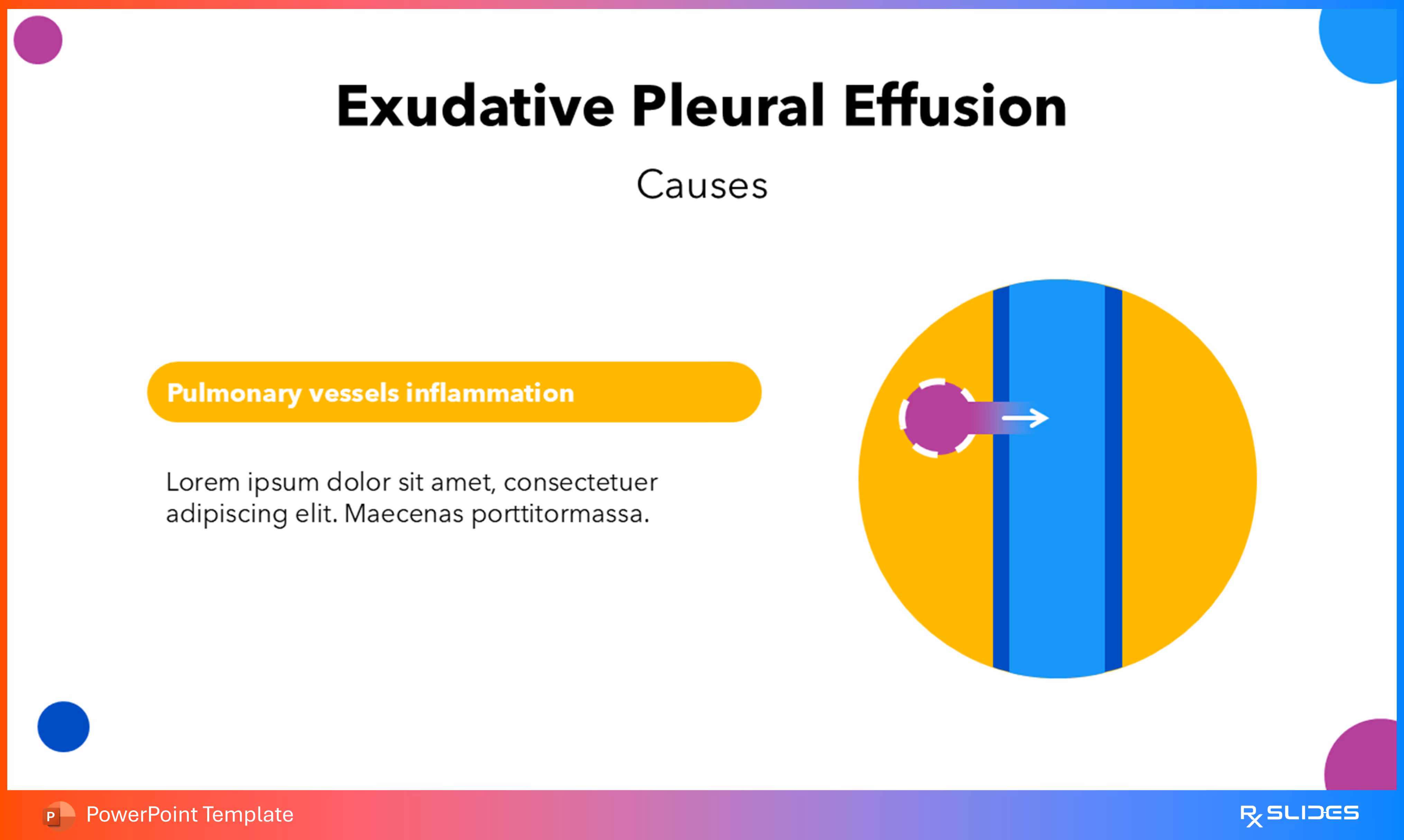 Exudative Pleural Effusion Causes (Specific Factors)