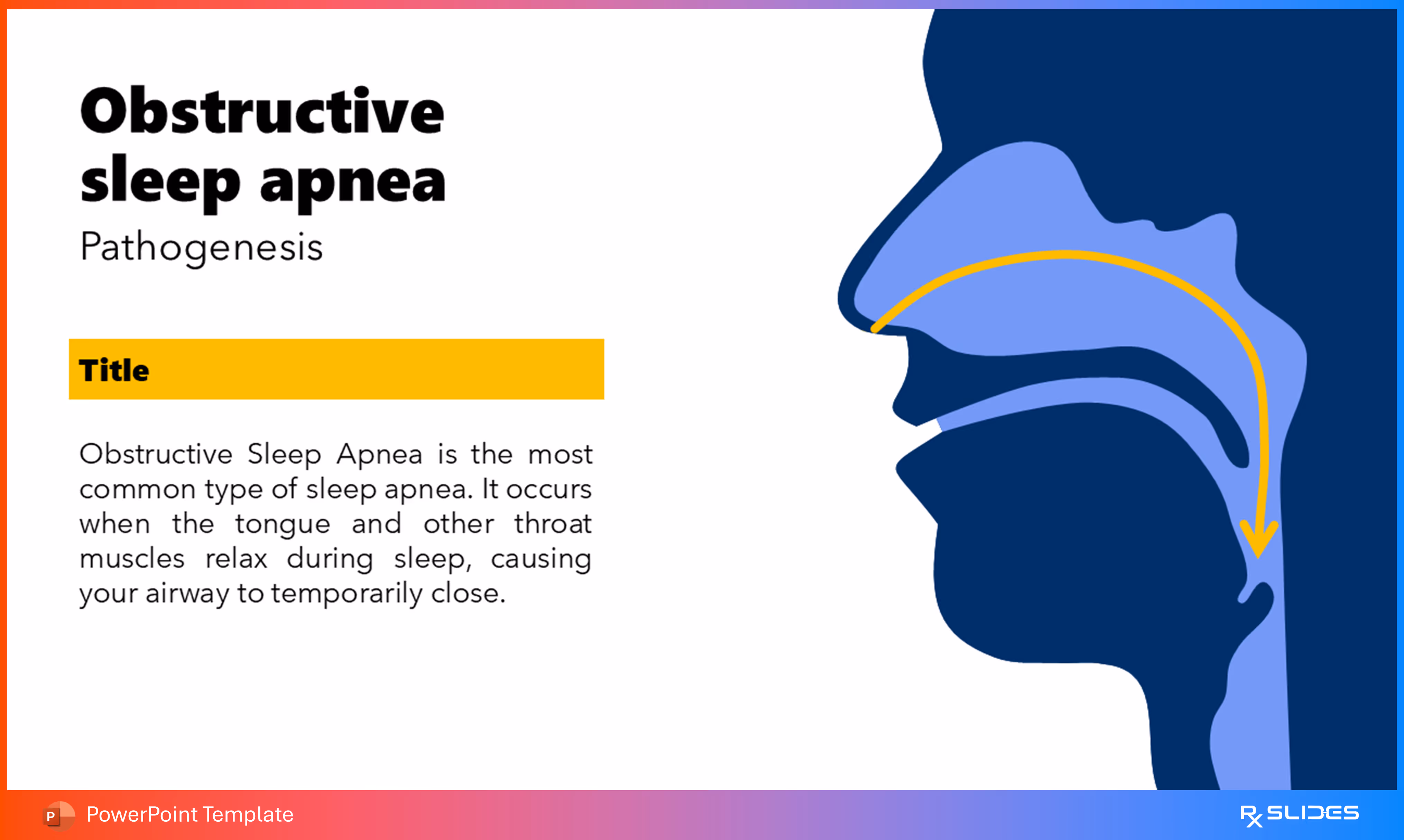 Obstructive Sleep Apnea Pathogenesis: Animated Medical Template