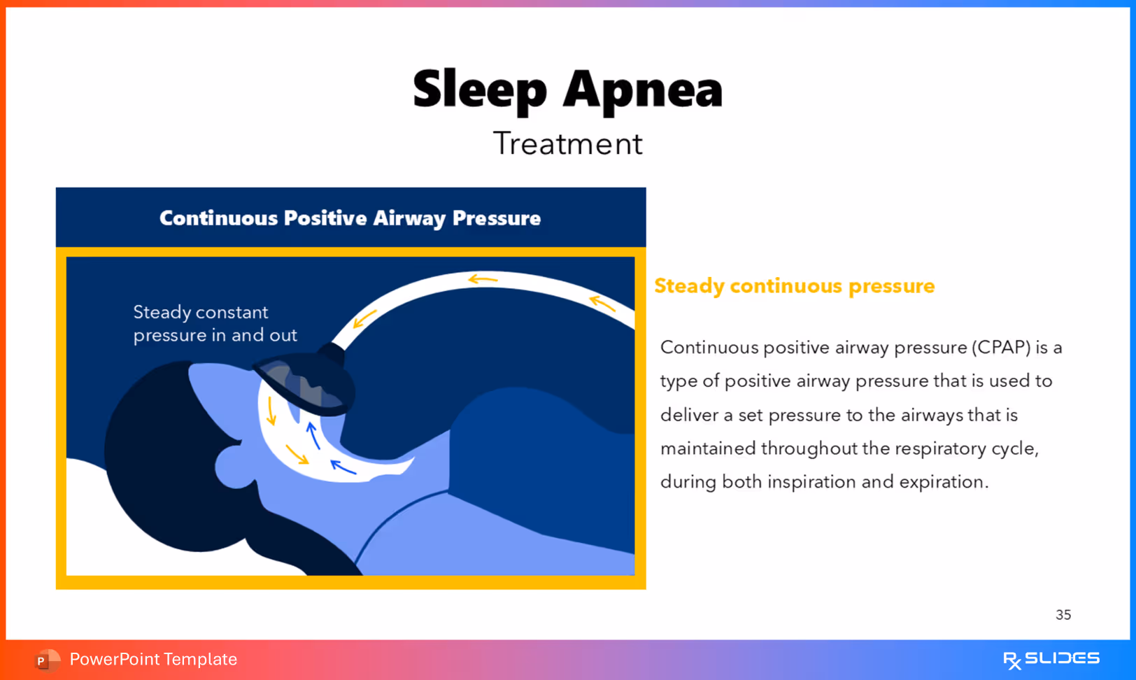 Treatment: Continuous Positive Airway Pressure (CPAP)