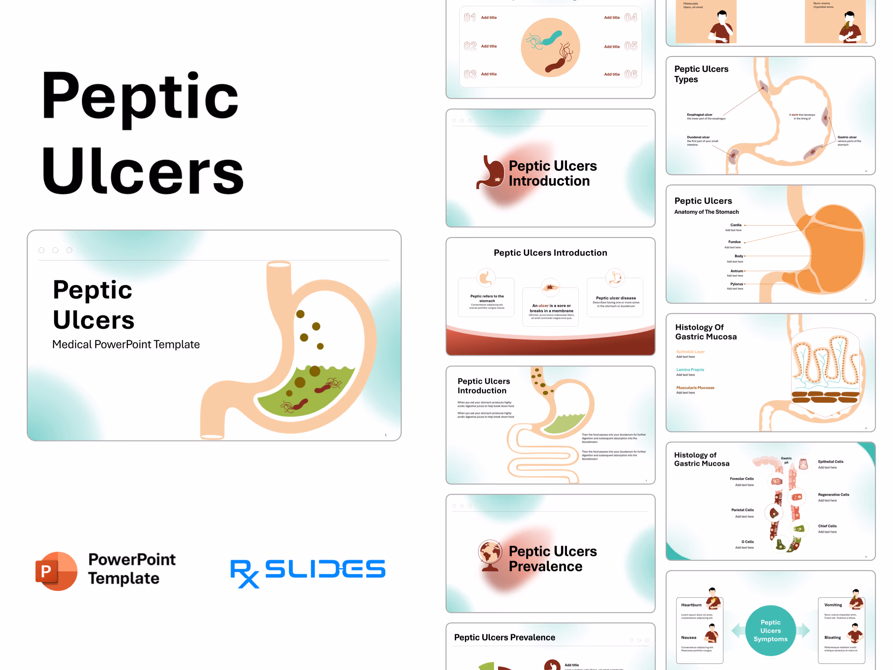 Peptic Ulcer Disease PowerPoint Template