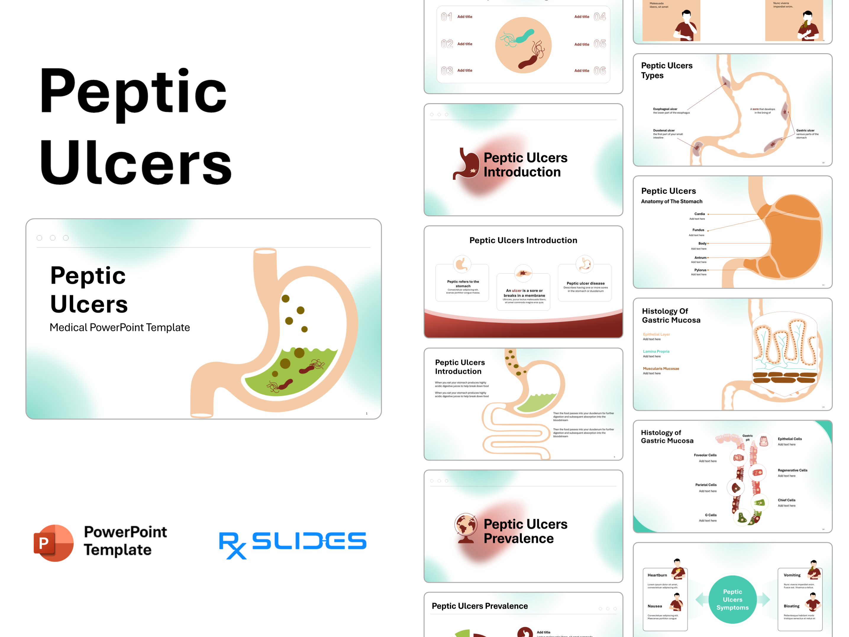 Peptic Ulcer Disease PowerPoint Template