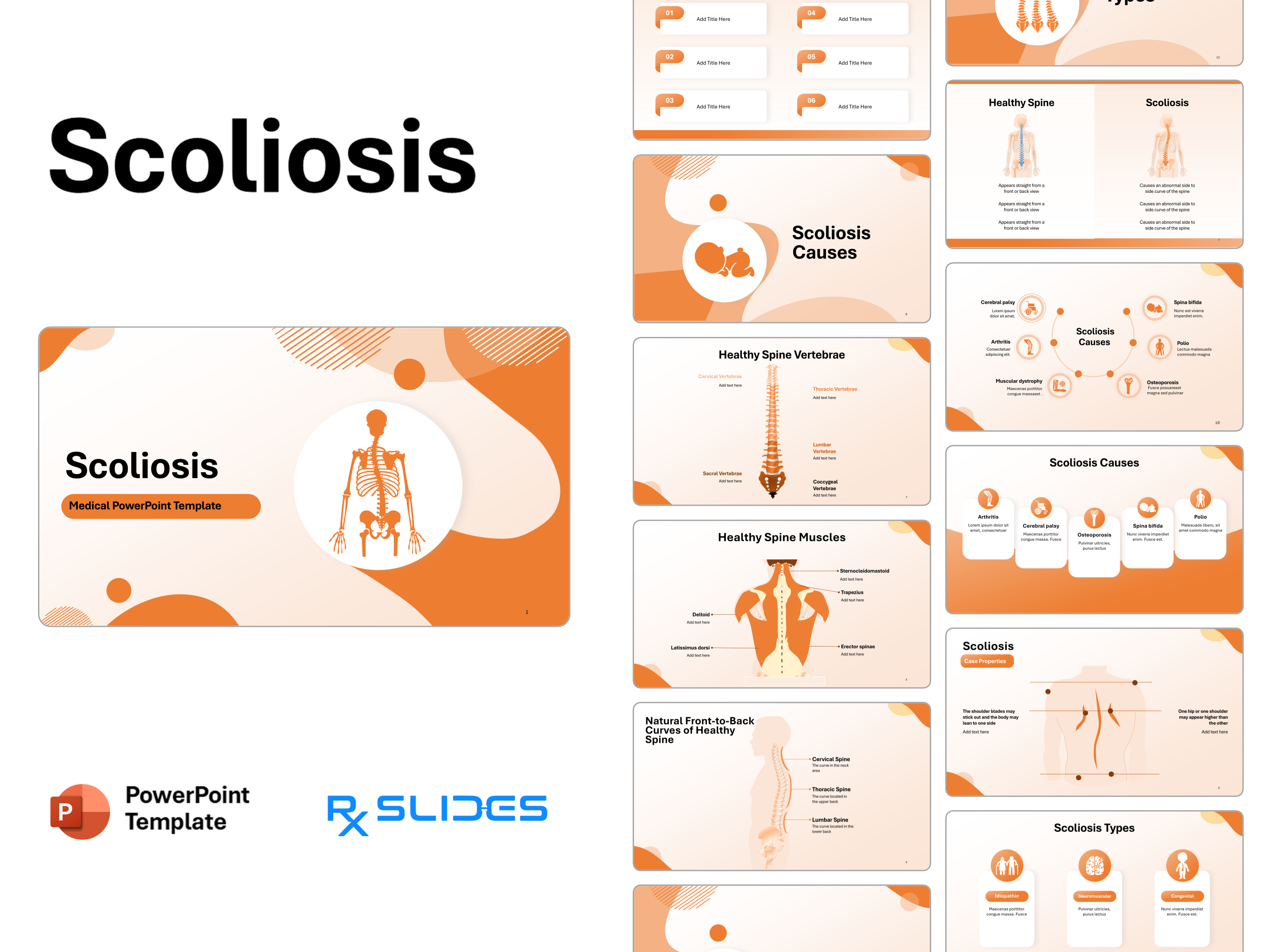 Scoliosis PowerPoint Template