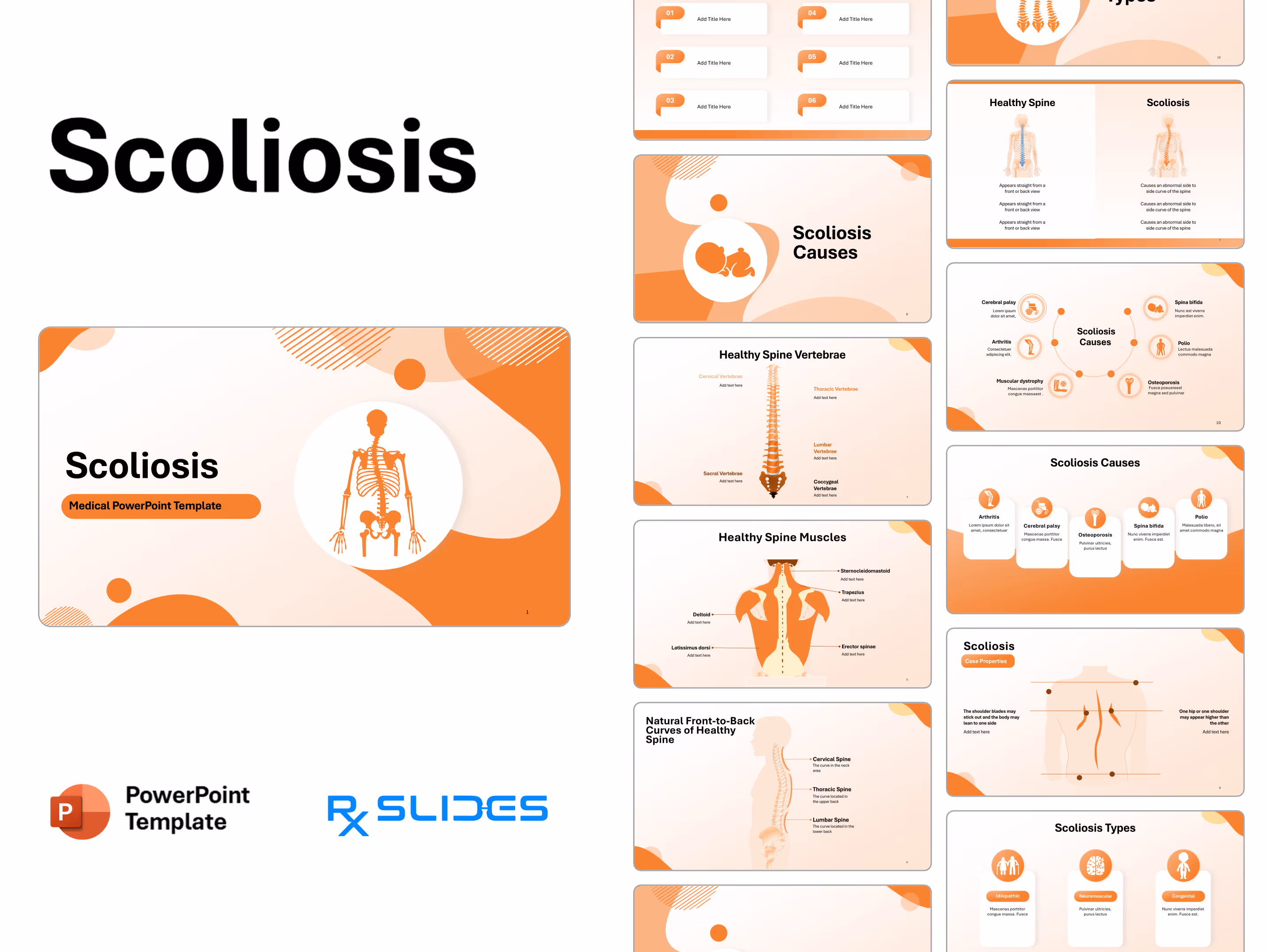Scoliosis PowerPoint Template