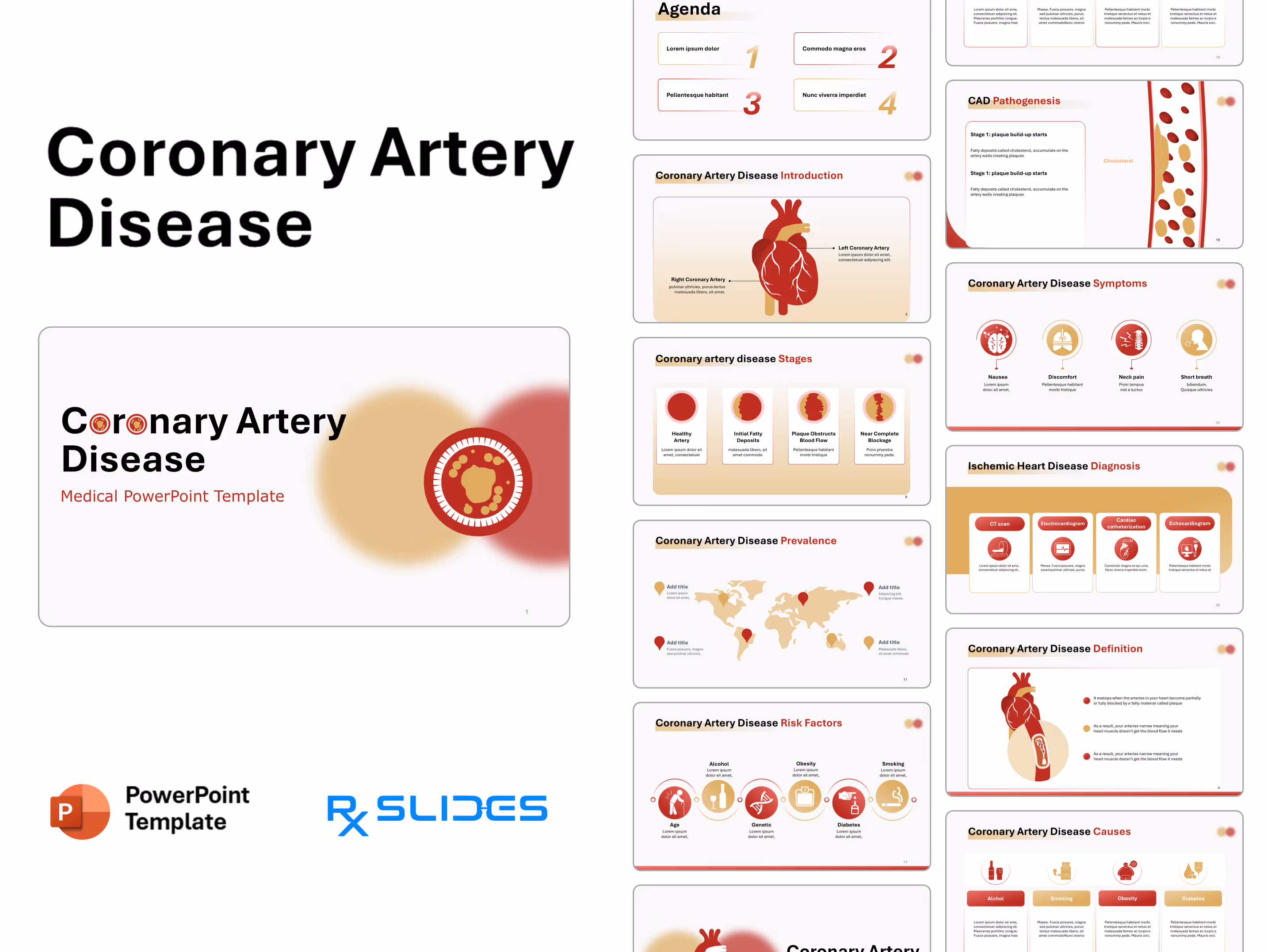 Coronary Artery Disease PowerPoint Template