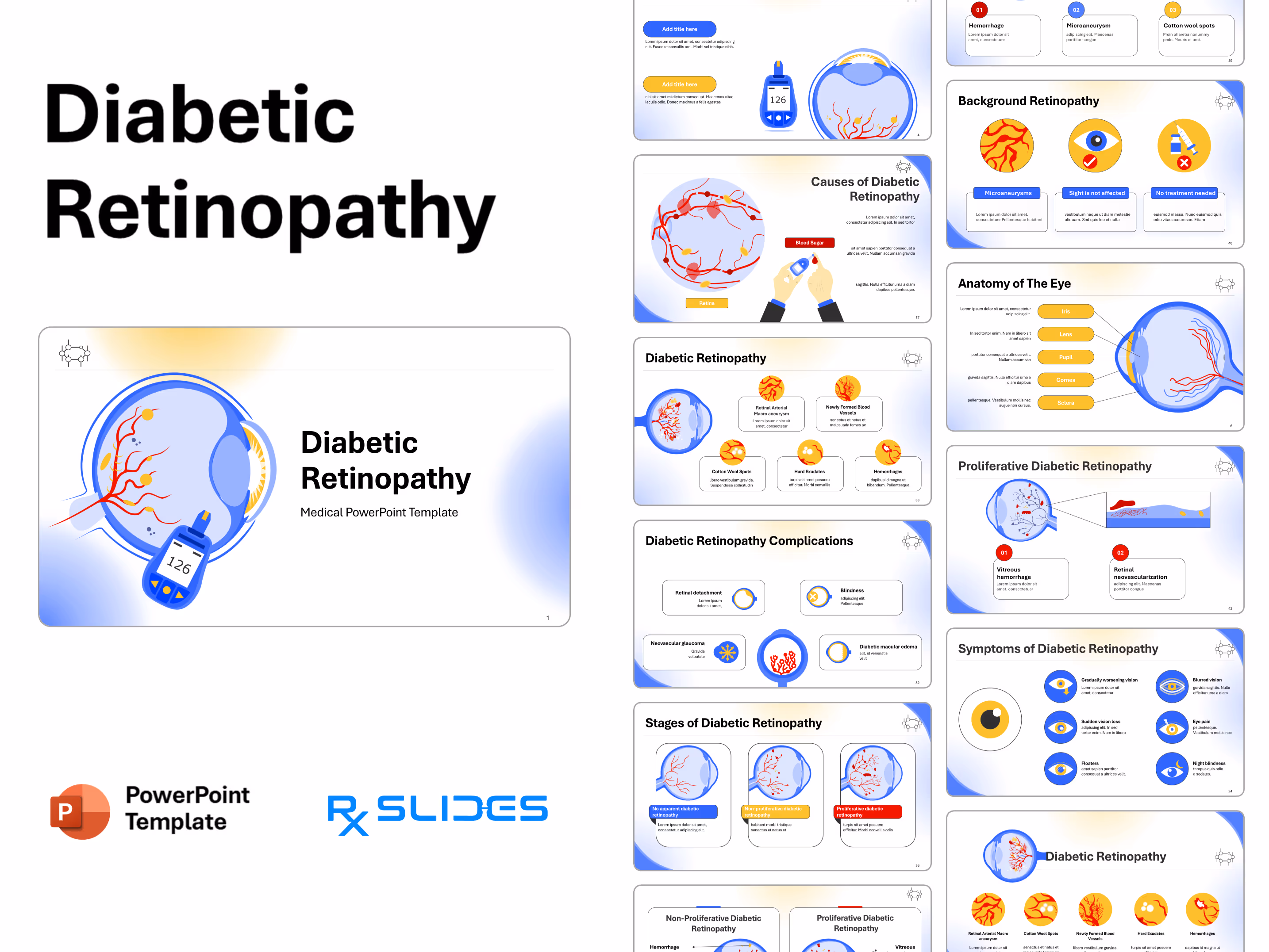 Diabetic Retinopathy PowerPoint Template