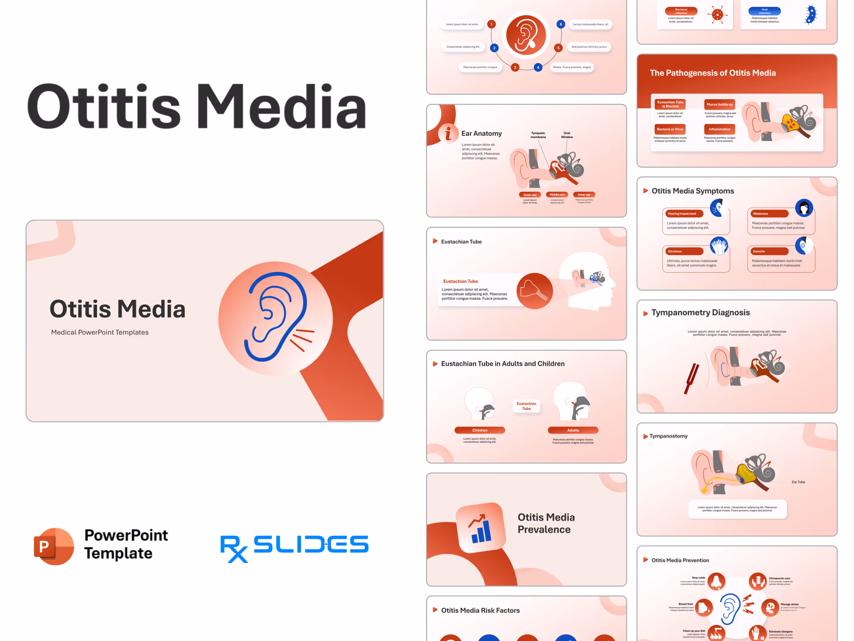Otitis Media PowerPoint Template