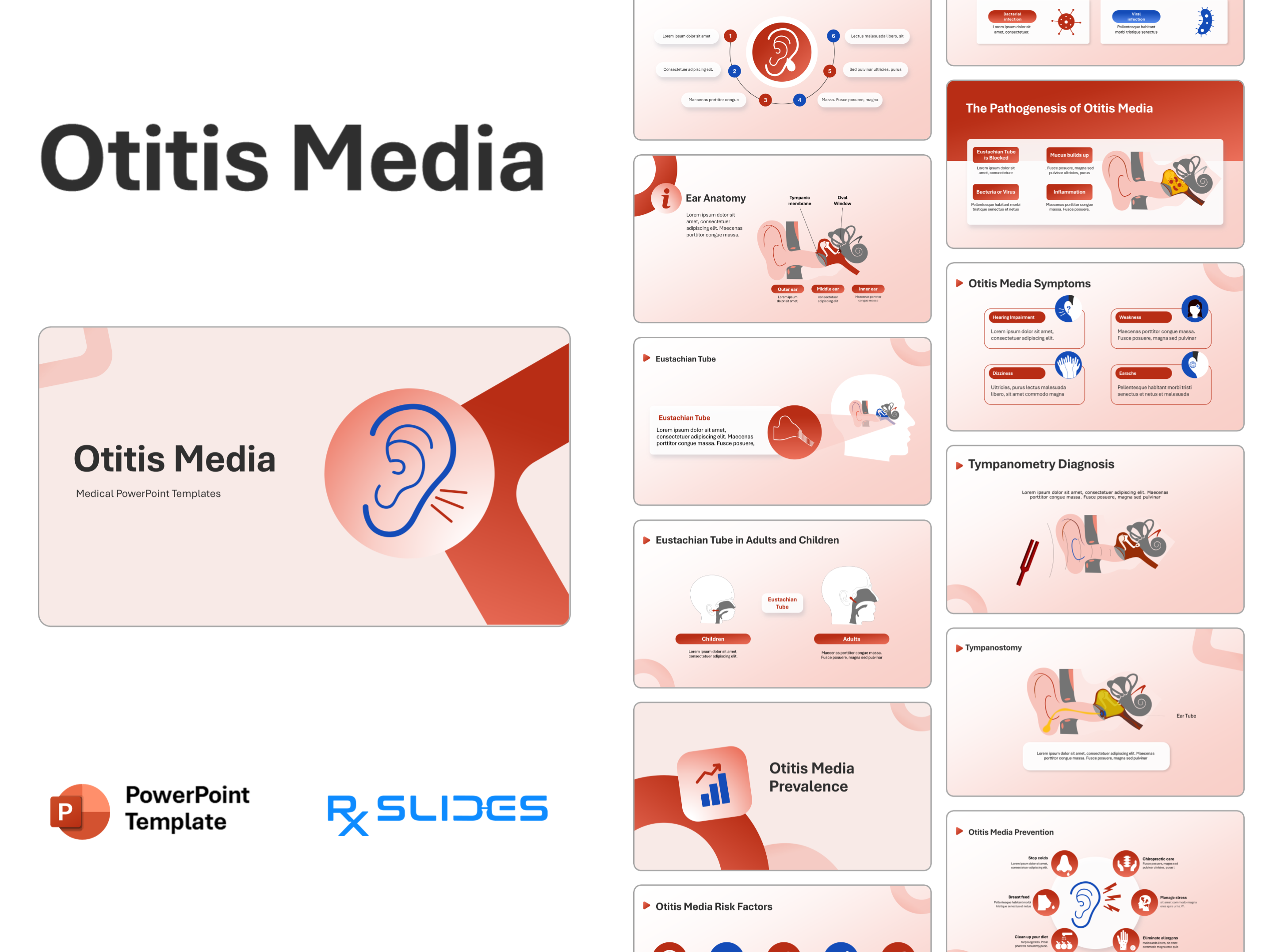 Otitis Media PowerPoint Template