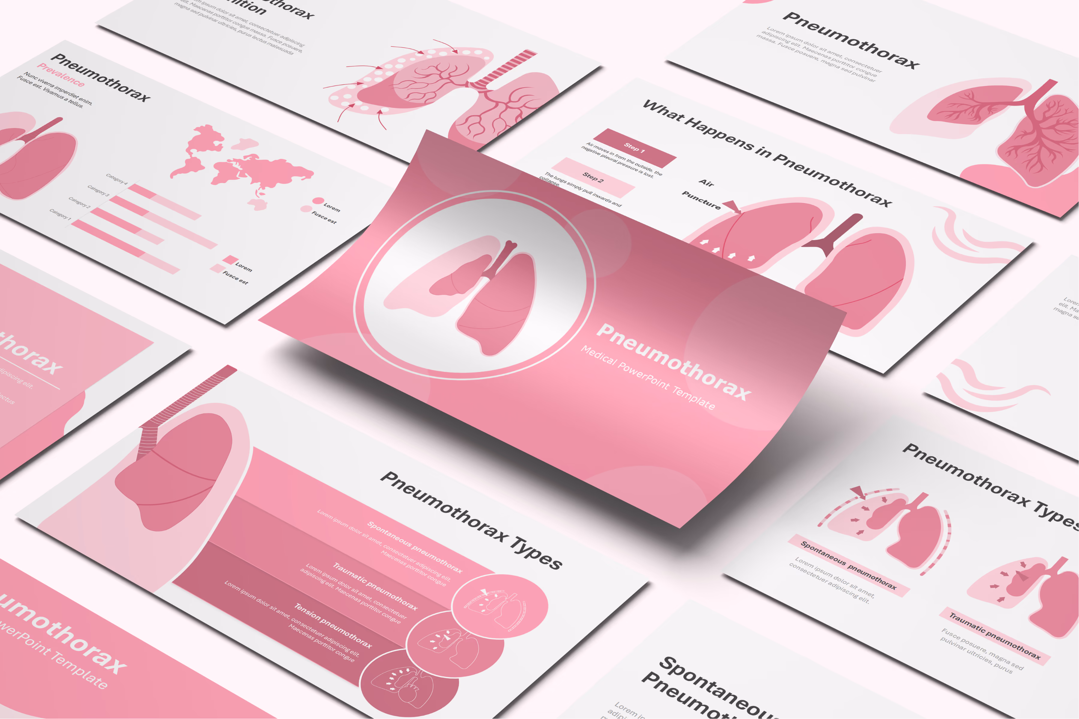 Pneumothorax PowerPoint Template