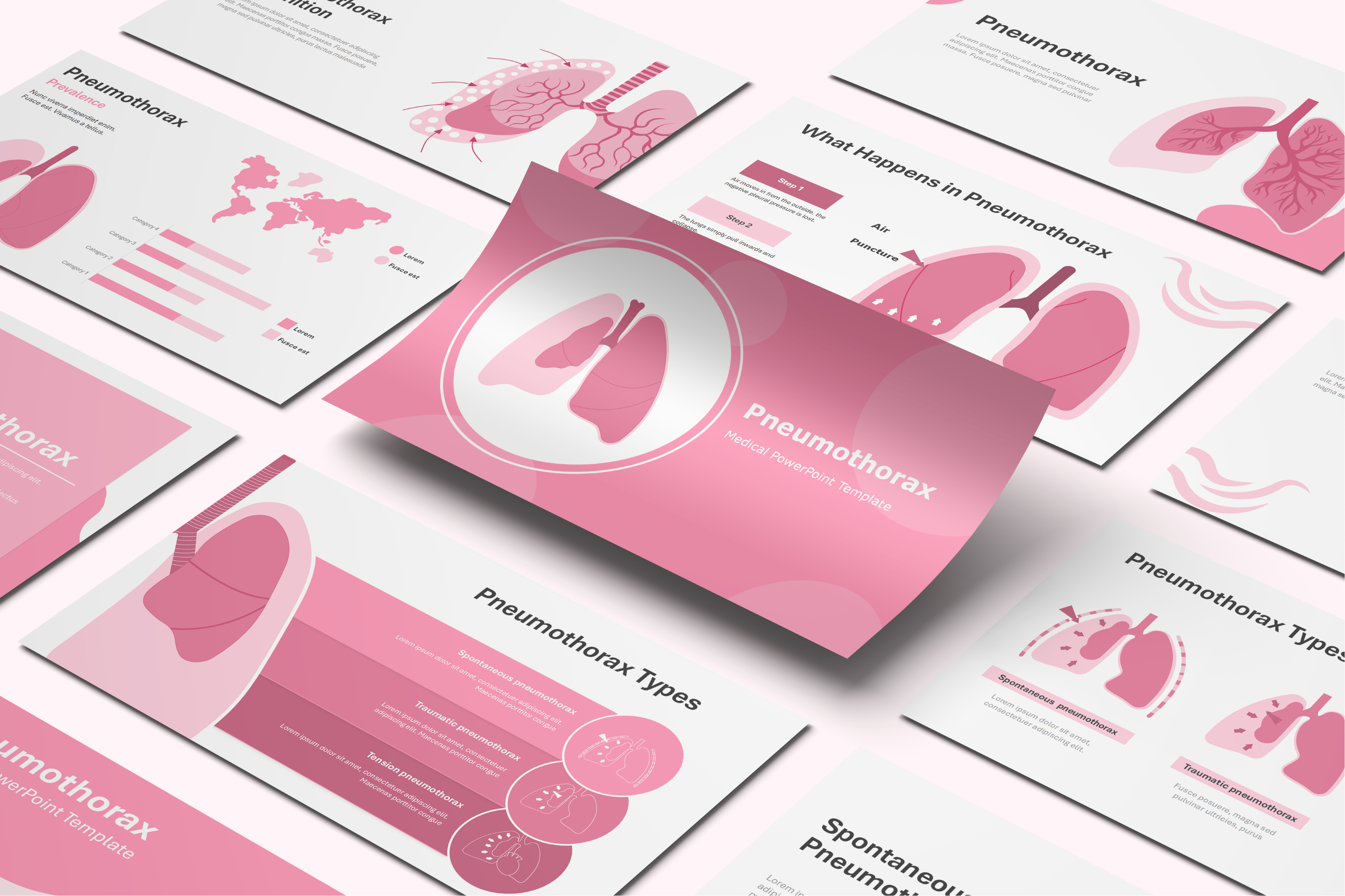 Pneumothorax PowerPoint Template