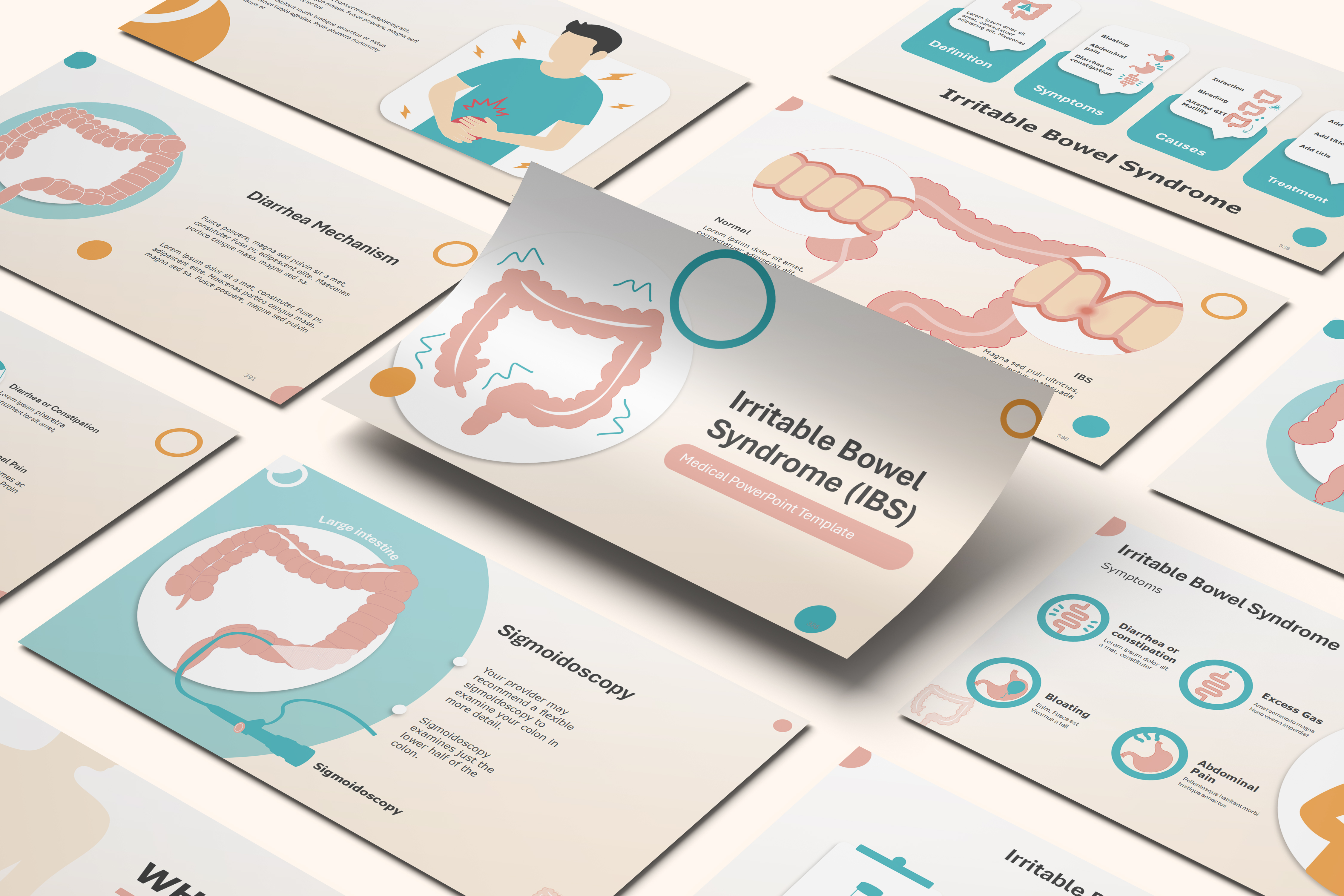Irritable bowel syndrome (IBS) PowerPoint Template