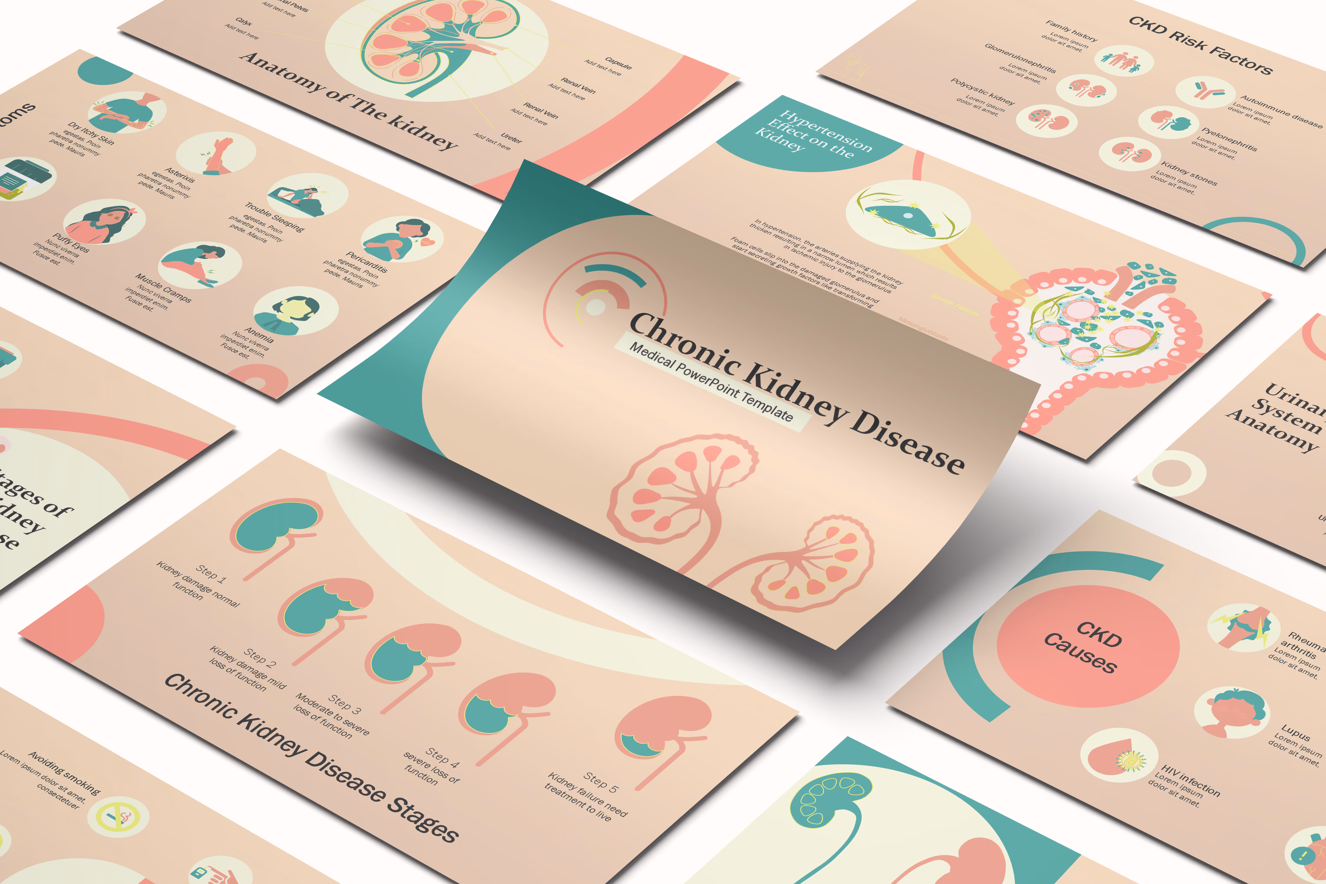 Chronic kidney Disease PowerPoint Template
