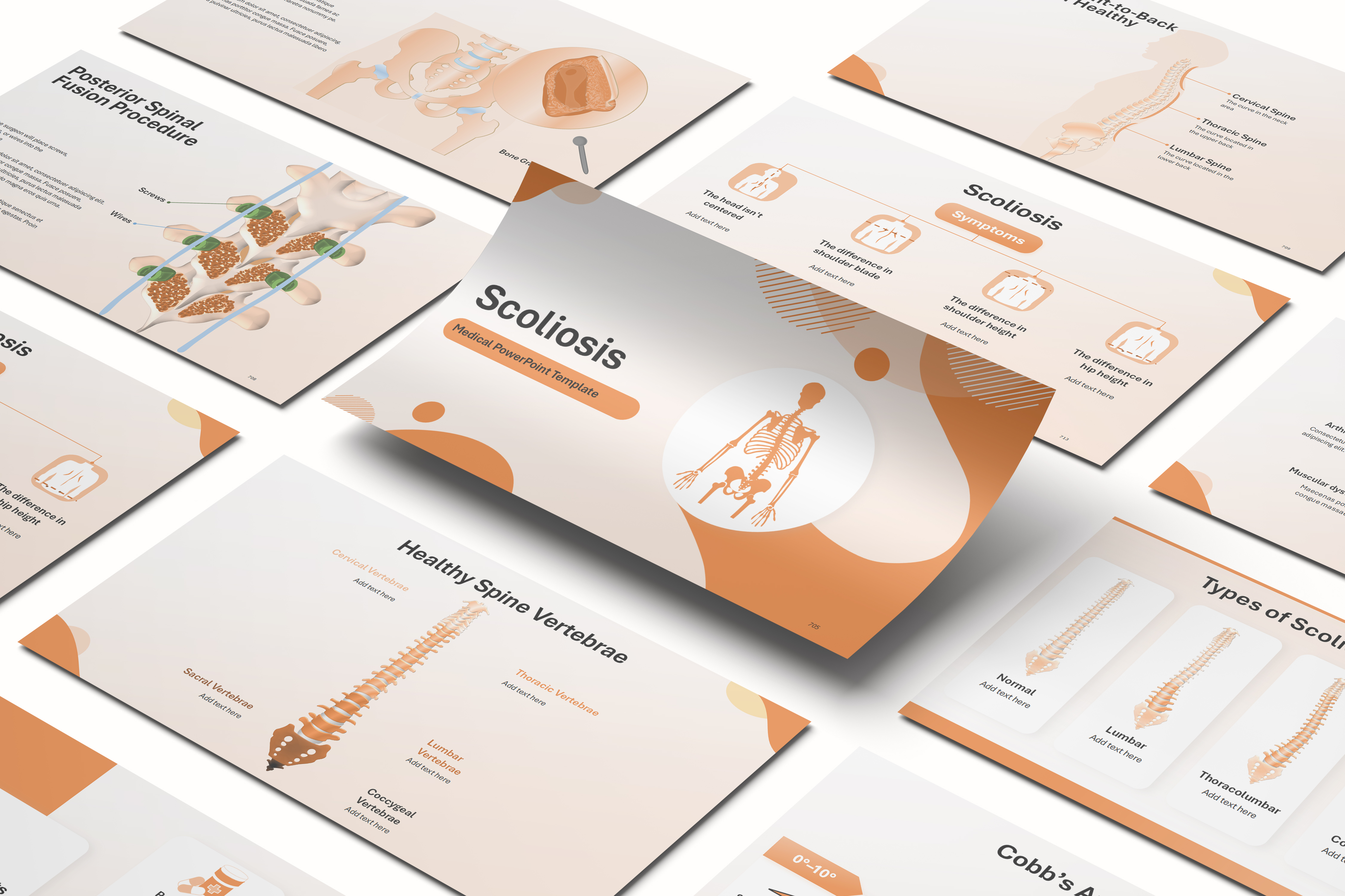 Scoliosis PowerPoint Template