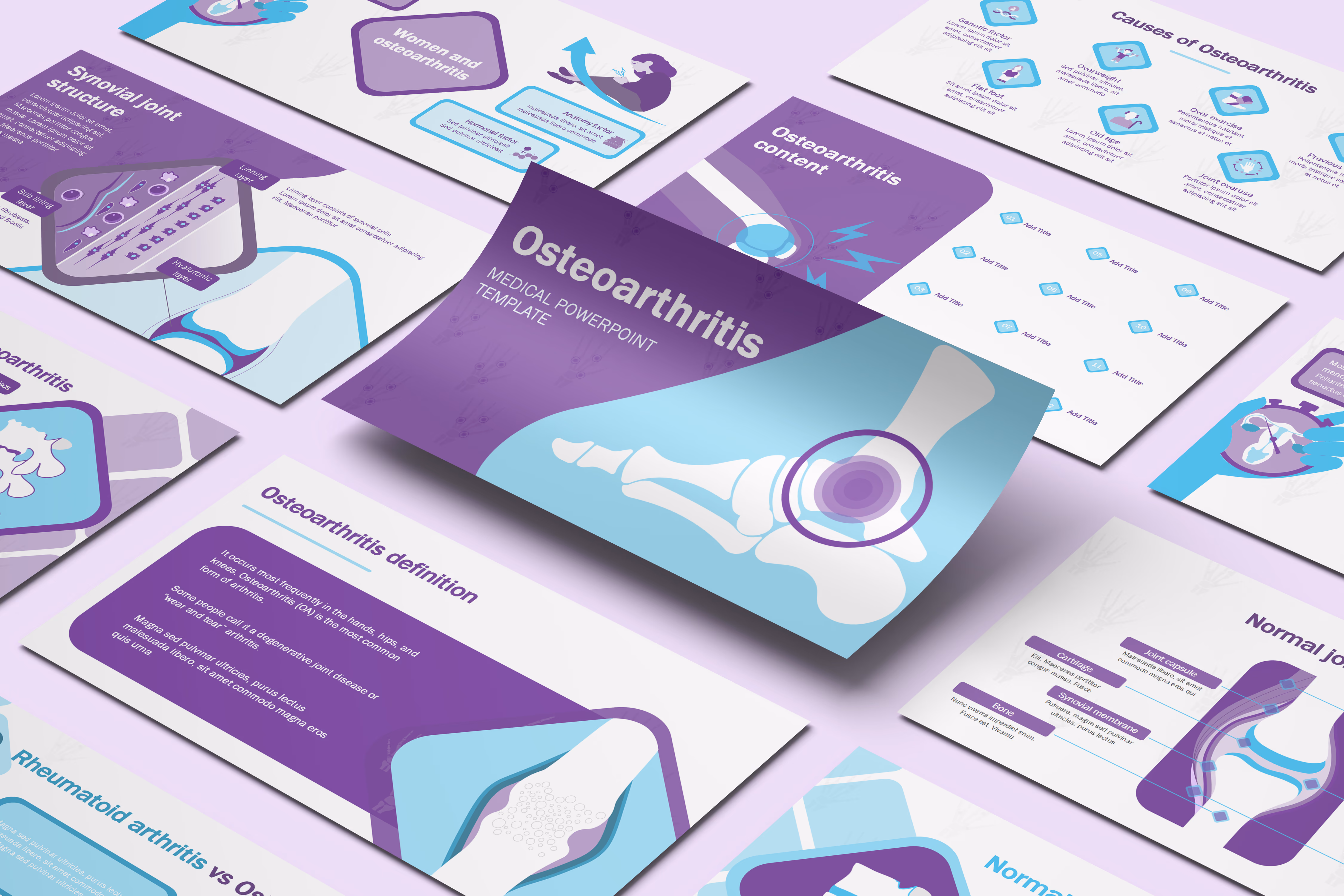 Osteoarthritis PowerPoint Template