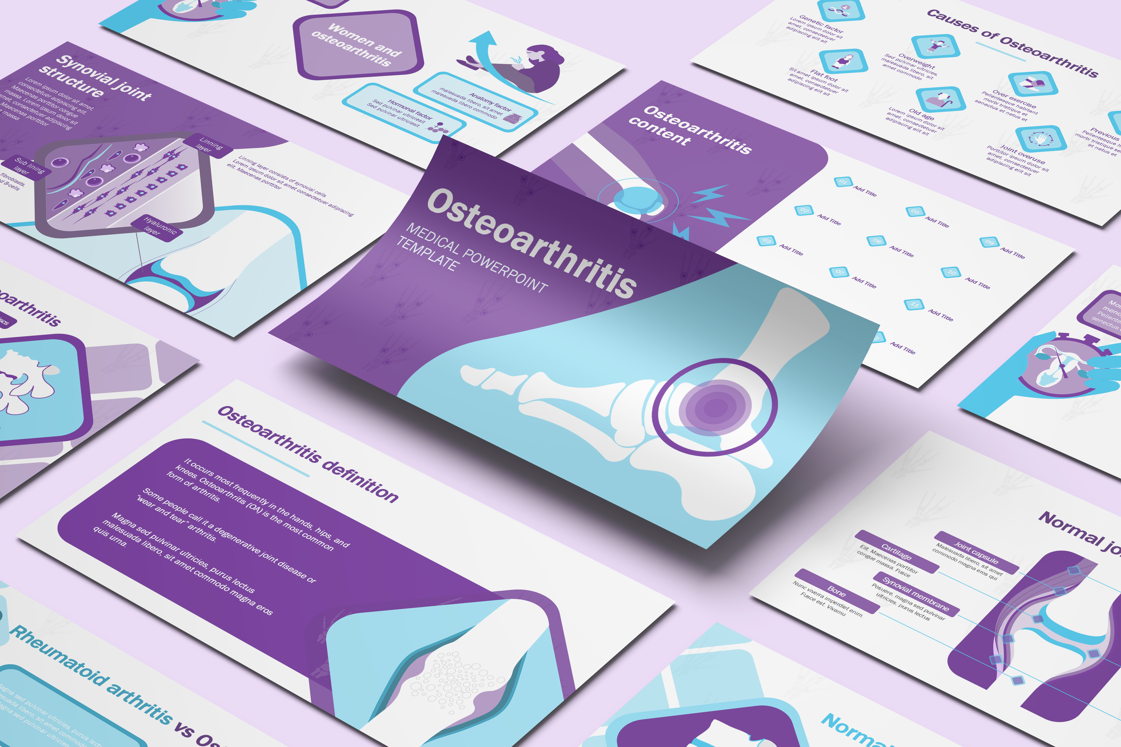Osteoarthritis PowerPoint Template