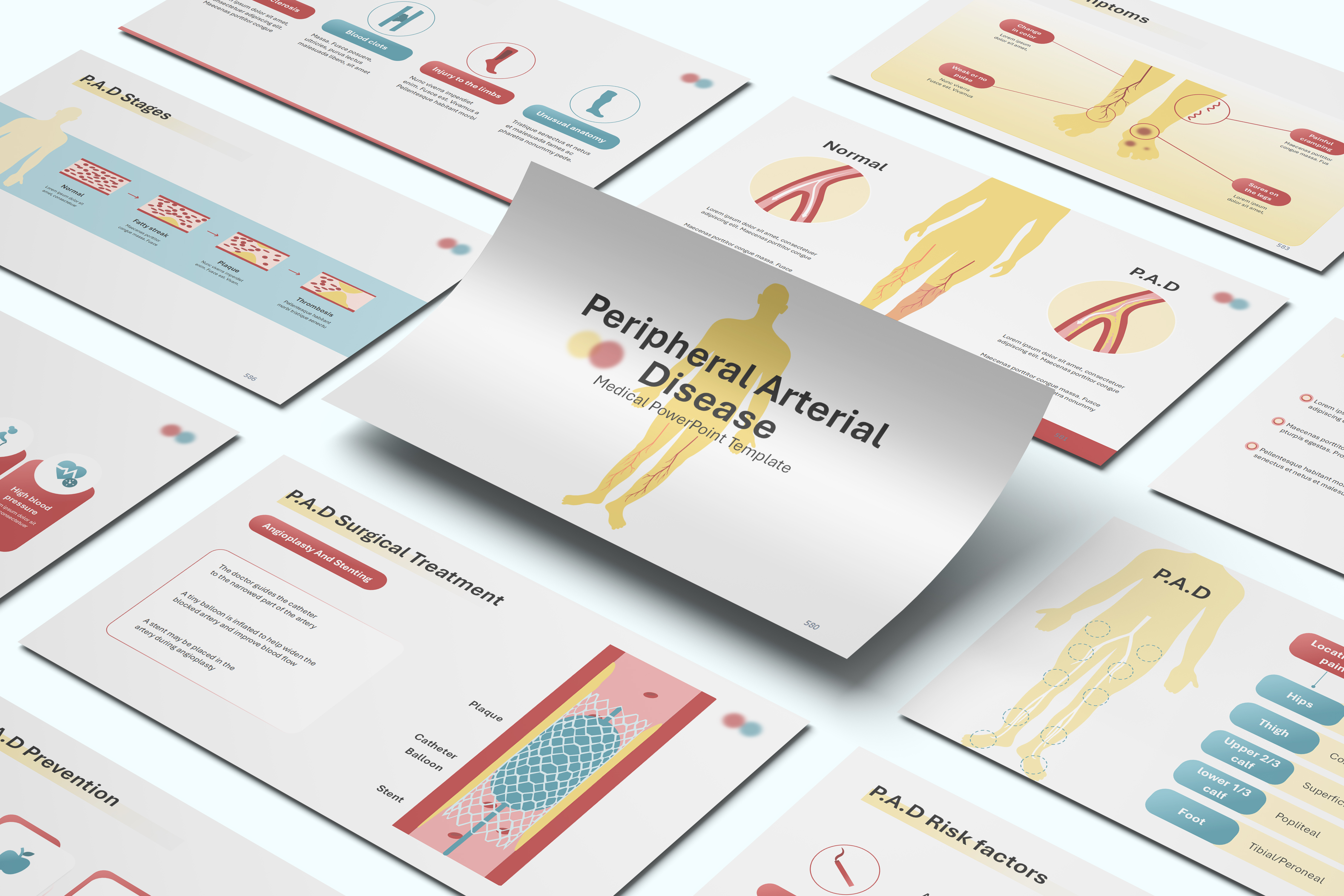 Peripheral Arterial Disease PowerPoint Template